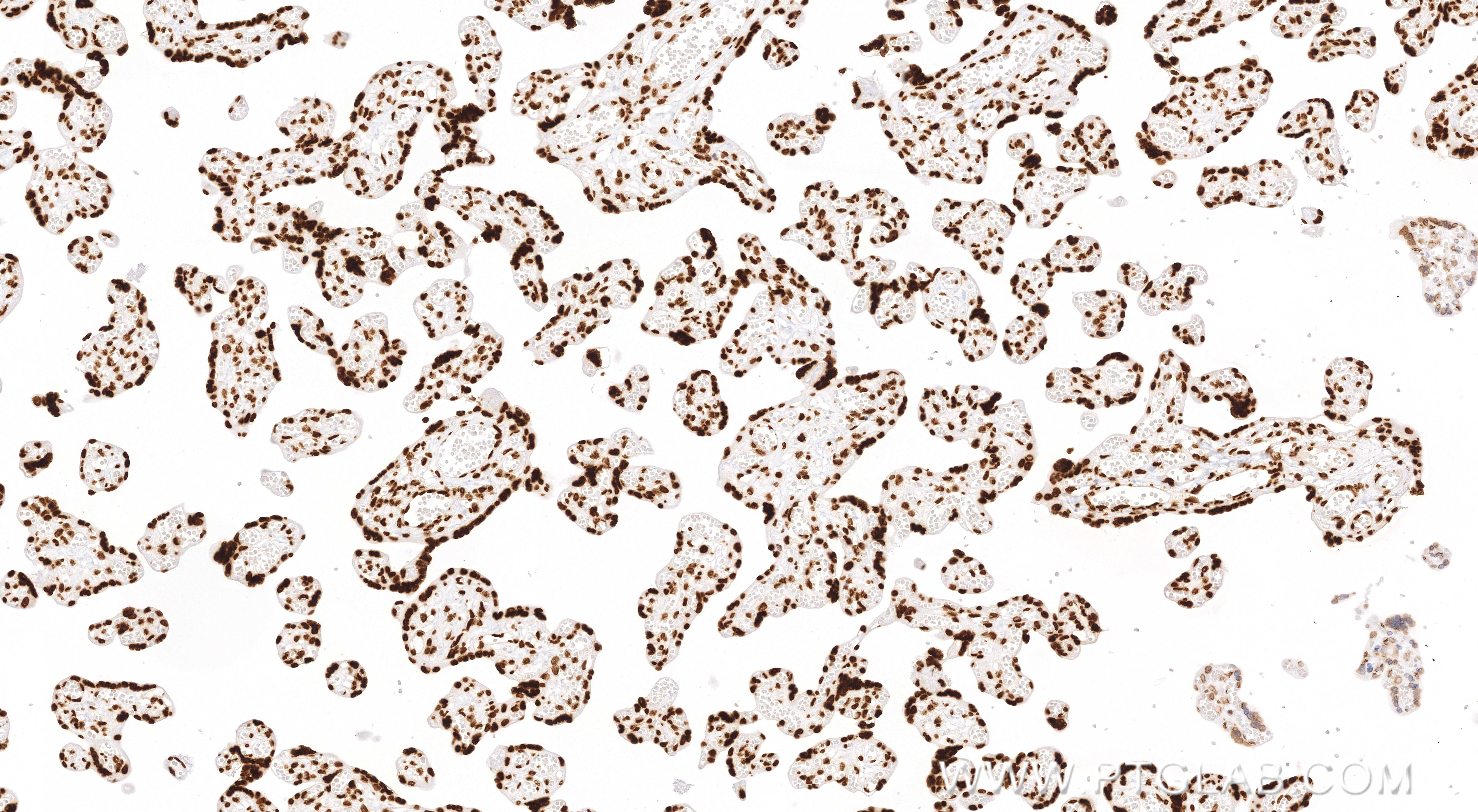 Immunohistochemical analysis of paraffin-embedded human placenta tissue slide using 82902-1-RR (Acetyl-Histone H3 (Lys27) antibody) at dilution of 1:2000 (under 10x lens). Heat mediated antigen retrieval with Tris-EDTA buffer (pH 9.0). IHC staining of human placenta using 82902-1-RR