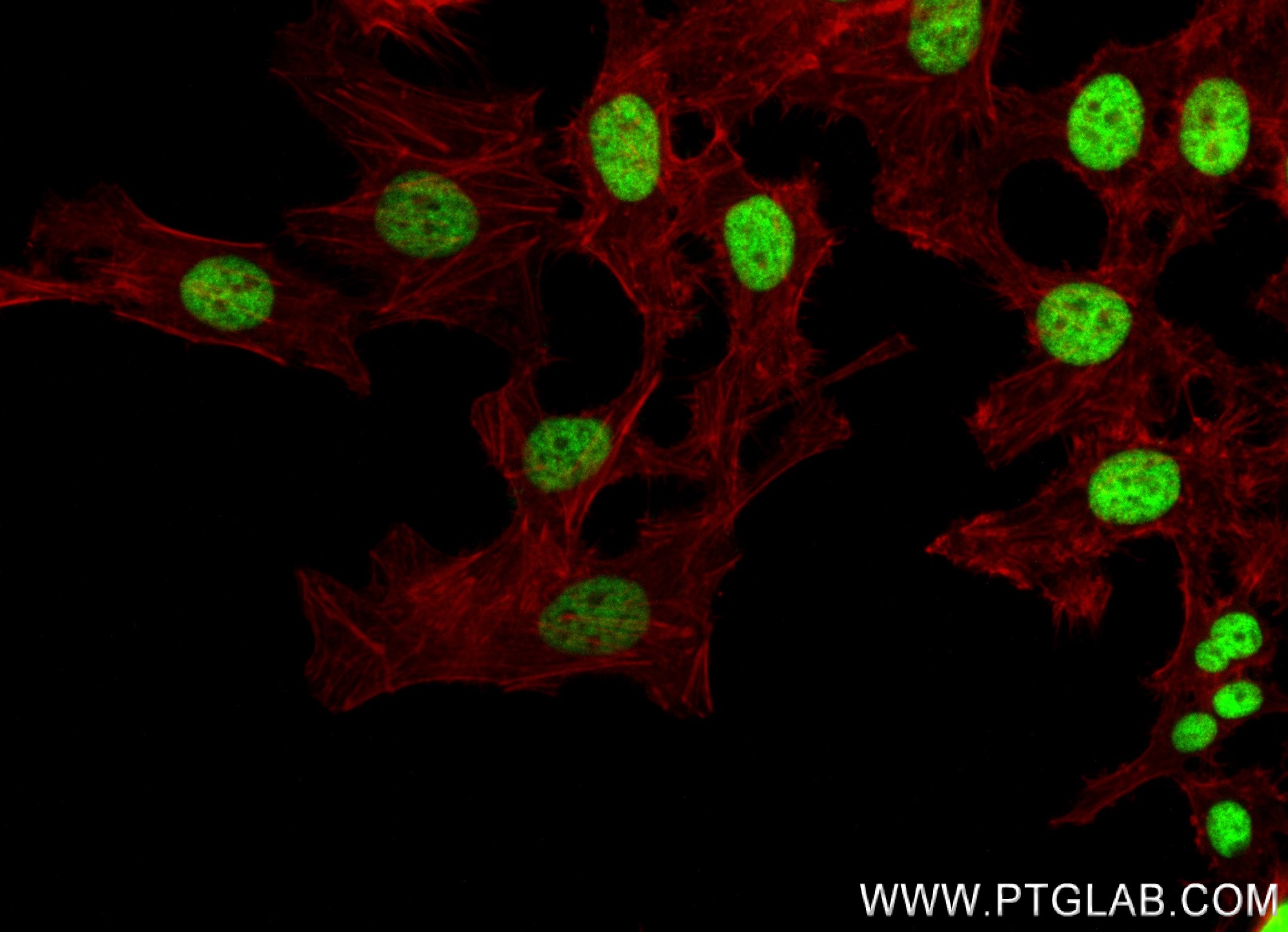 IF Staining of HeLa using 84831-1-RR