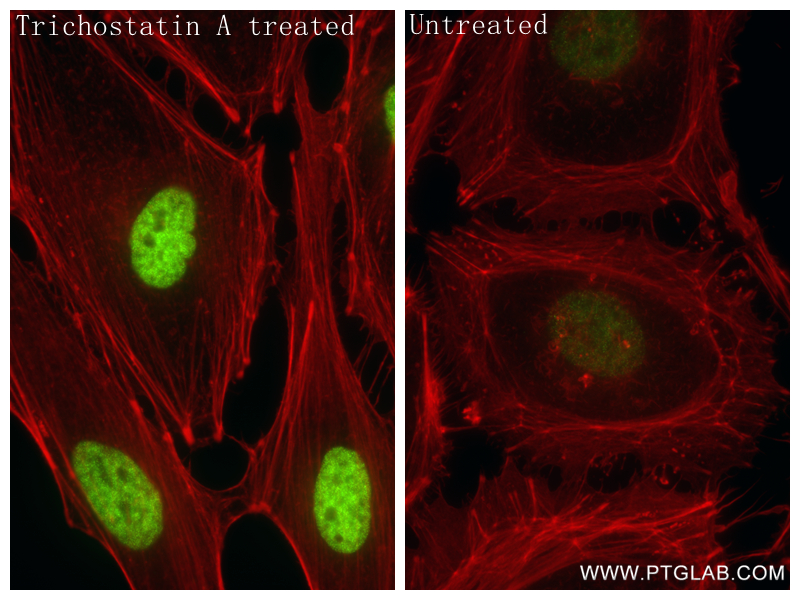 IF Staining of HeLa using 84831-1-RR