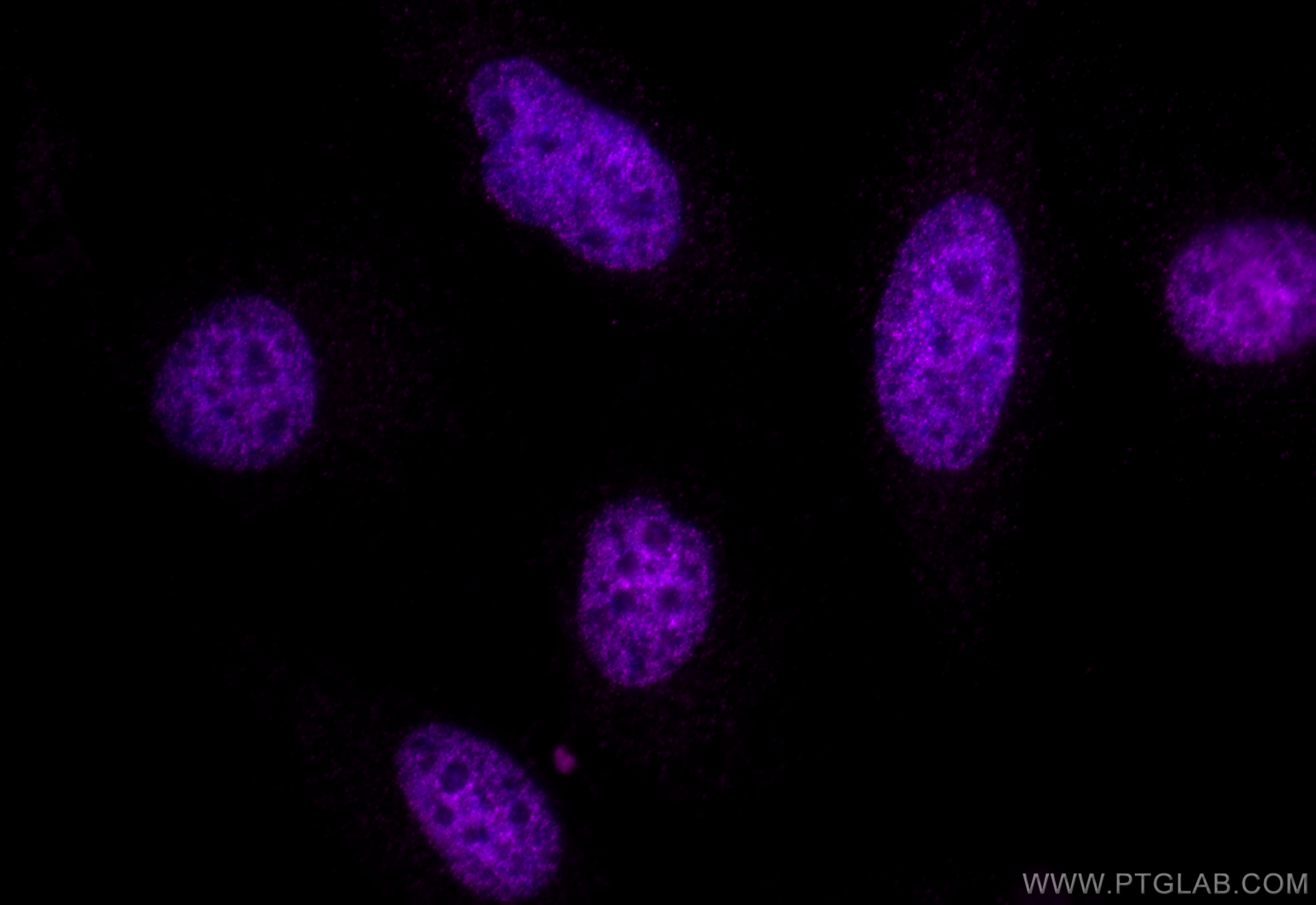 IF Staining of HeLa using CL647-84831