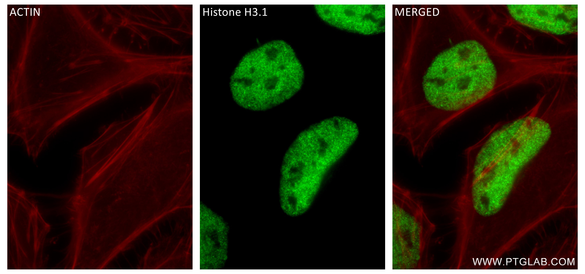 IF Staining of HeLa using 84543-1-RR