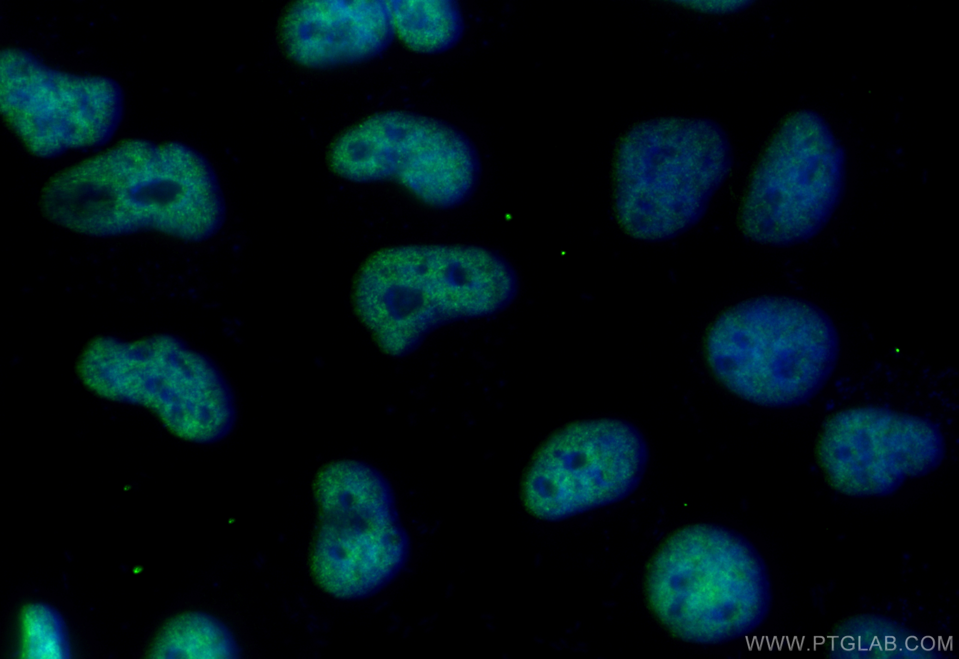 IF Staining of HeLa using CL488-84543