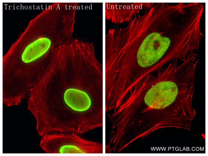 IF Staining of HeLa using 86860-1-RR IF Staining of HeLa using 86860-1-RR