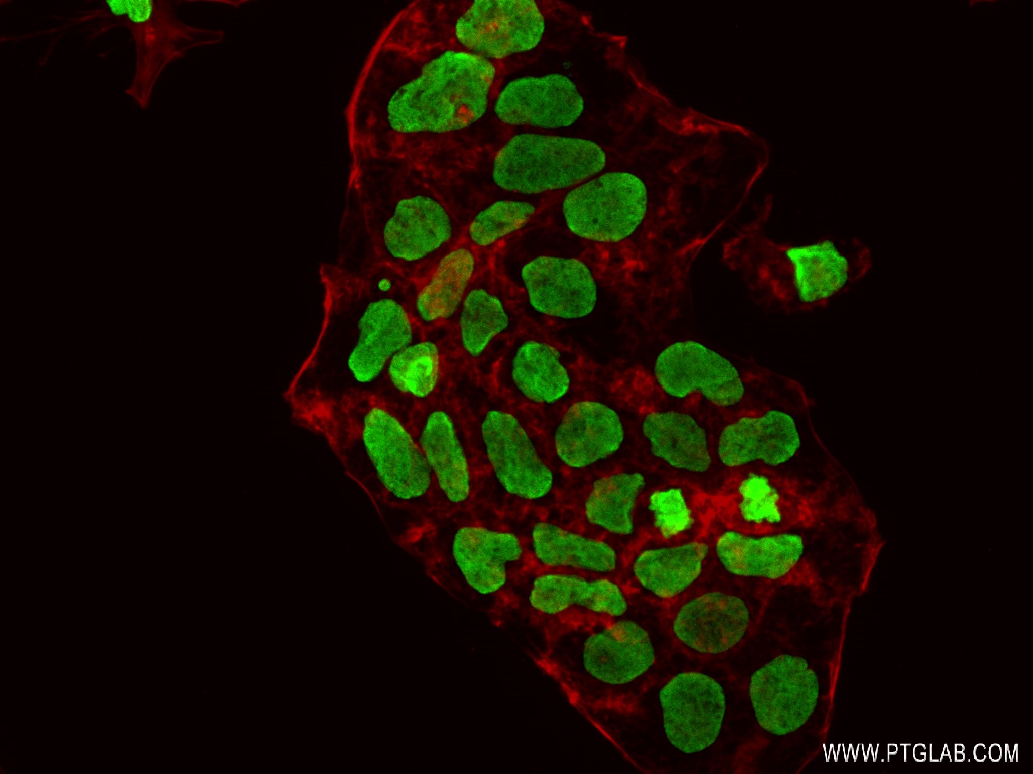 IF Staining of Caco-2 using 83095-1-RR (same clone as 83095-1-PBS)