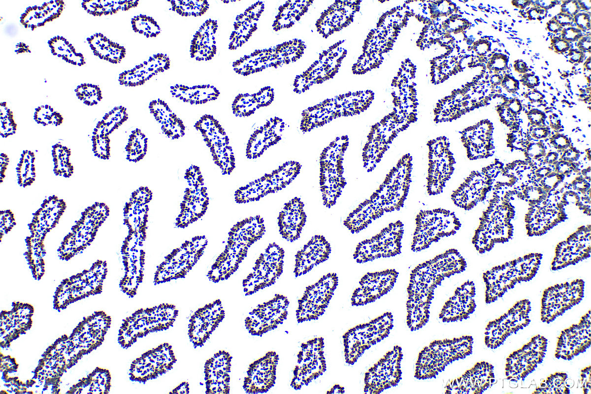 IHC staining of mouse small intestine using 83095-1-RR (same clone as 83095-1-PBS)