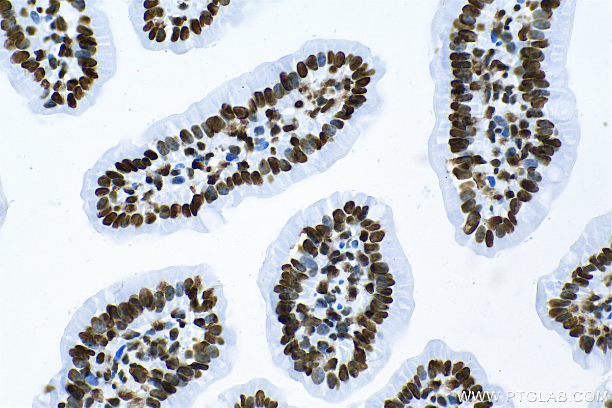 IHC staining of mouse small intestine using 83095-1-RR (same clone as 83095-1-PBS)