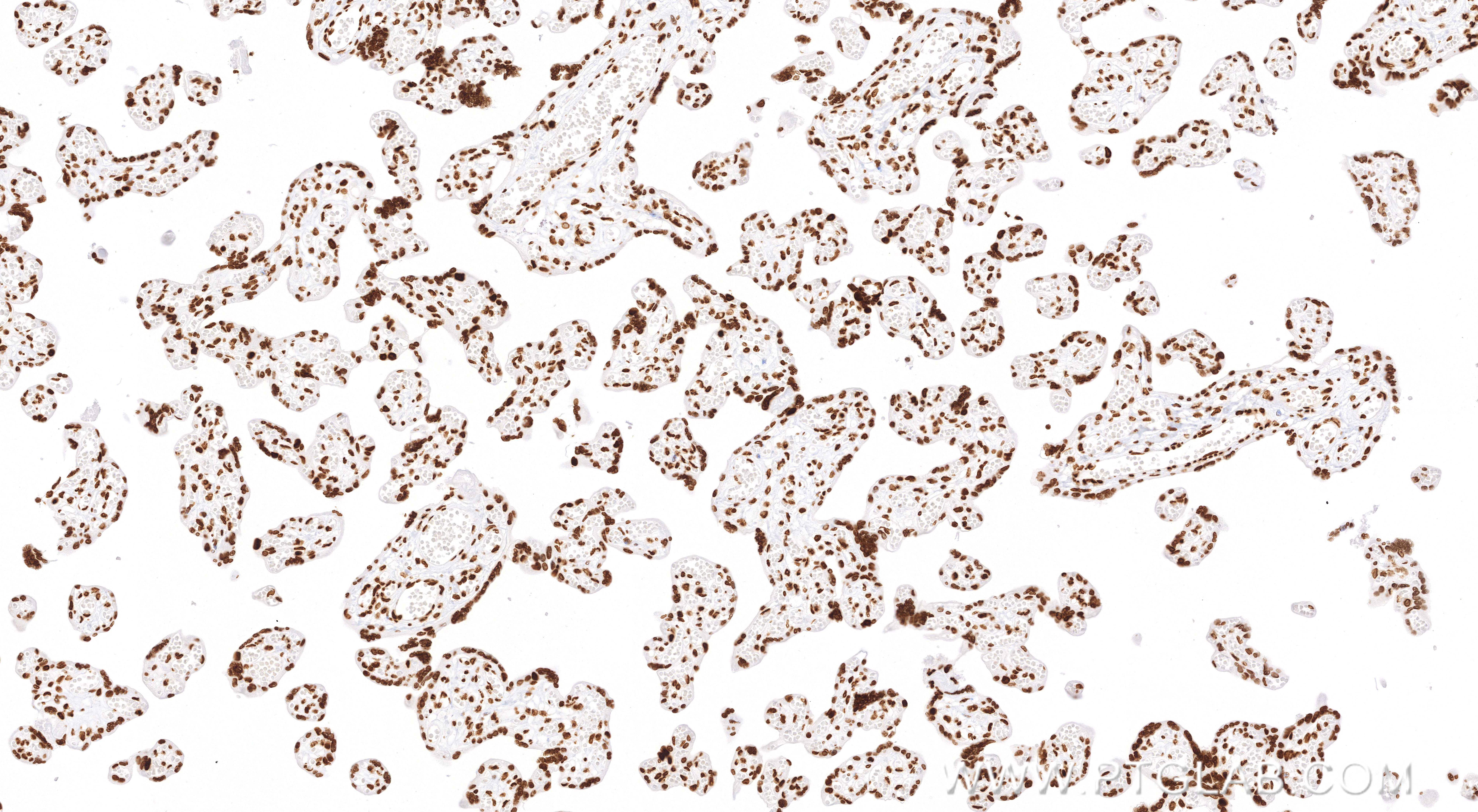 IHC staining of human placenta using 83095-1-RR
