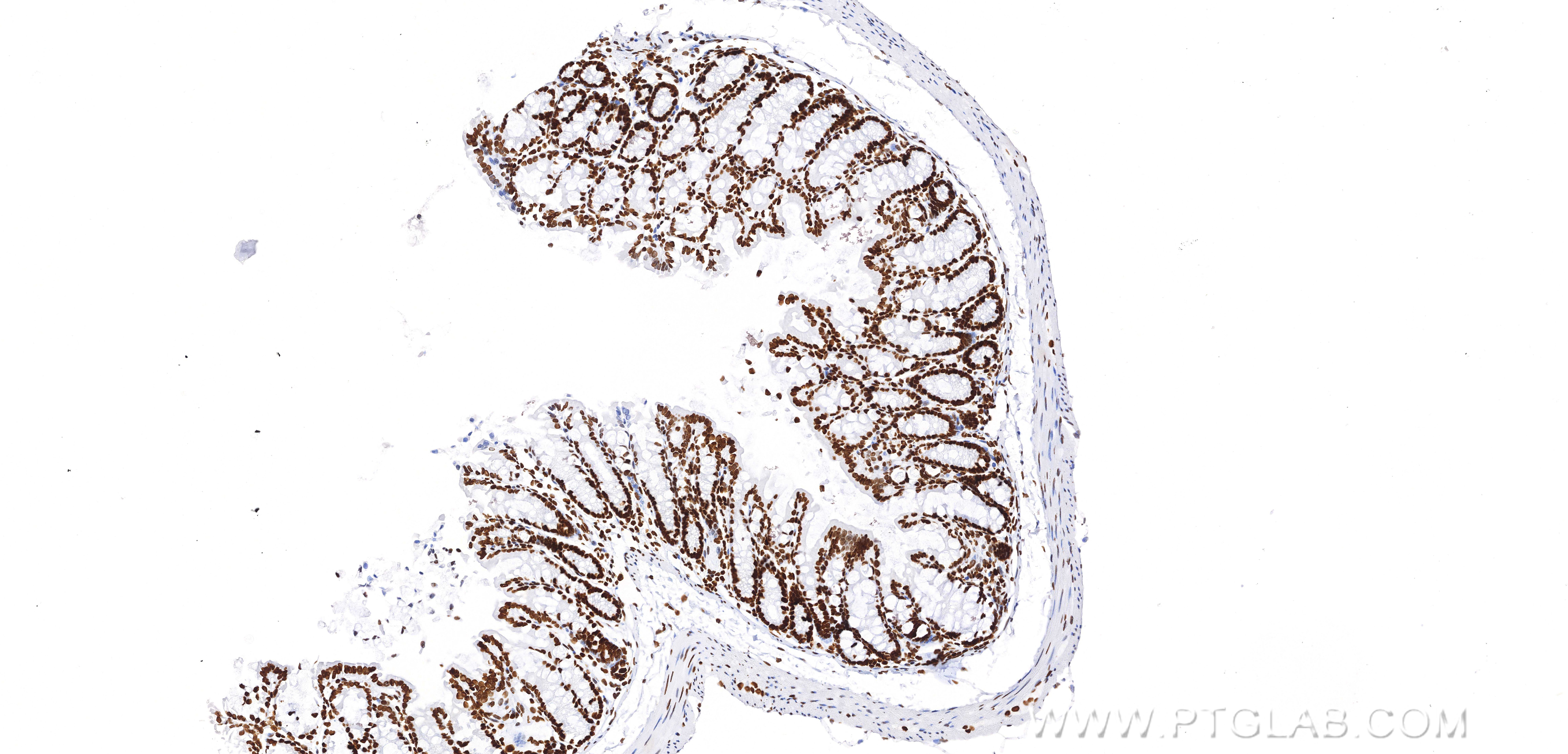 IHC staining of mouse colon using 83095-1-RR
