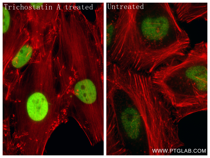 IF Staining of HeLa using 86768-1-RR (same clone as 86768-1-PBS) IF Staining of HeLa using 86768-1-RR (same clone as 86768-1-PBS)
