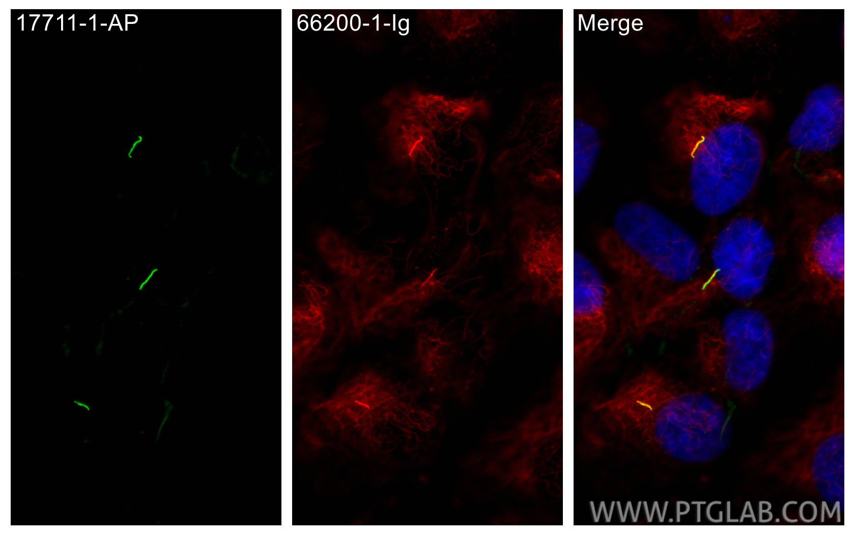 IF Staining of hTERT-RPE1 using 66200-1-Ig