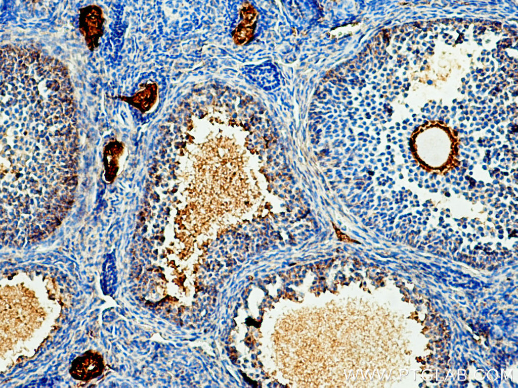IHC staining of mouse ovary using 66200-1-Ig