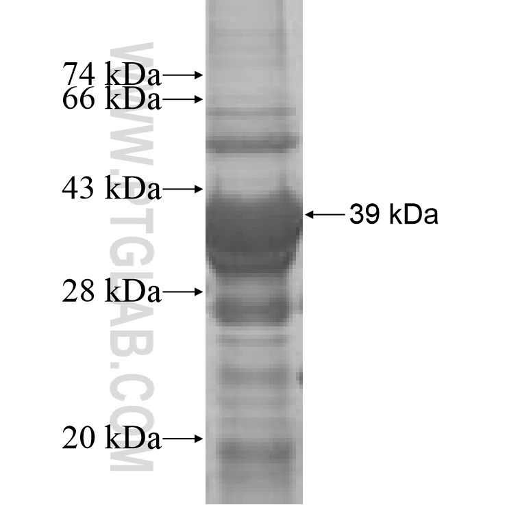 Acsl3 fusion protein Ag7433 SDS-PAGE Acsl3 fusion protein Ag7433 SDS-PAGE