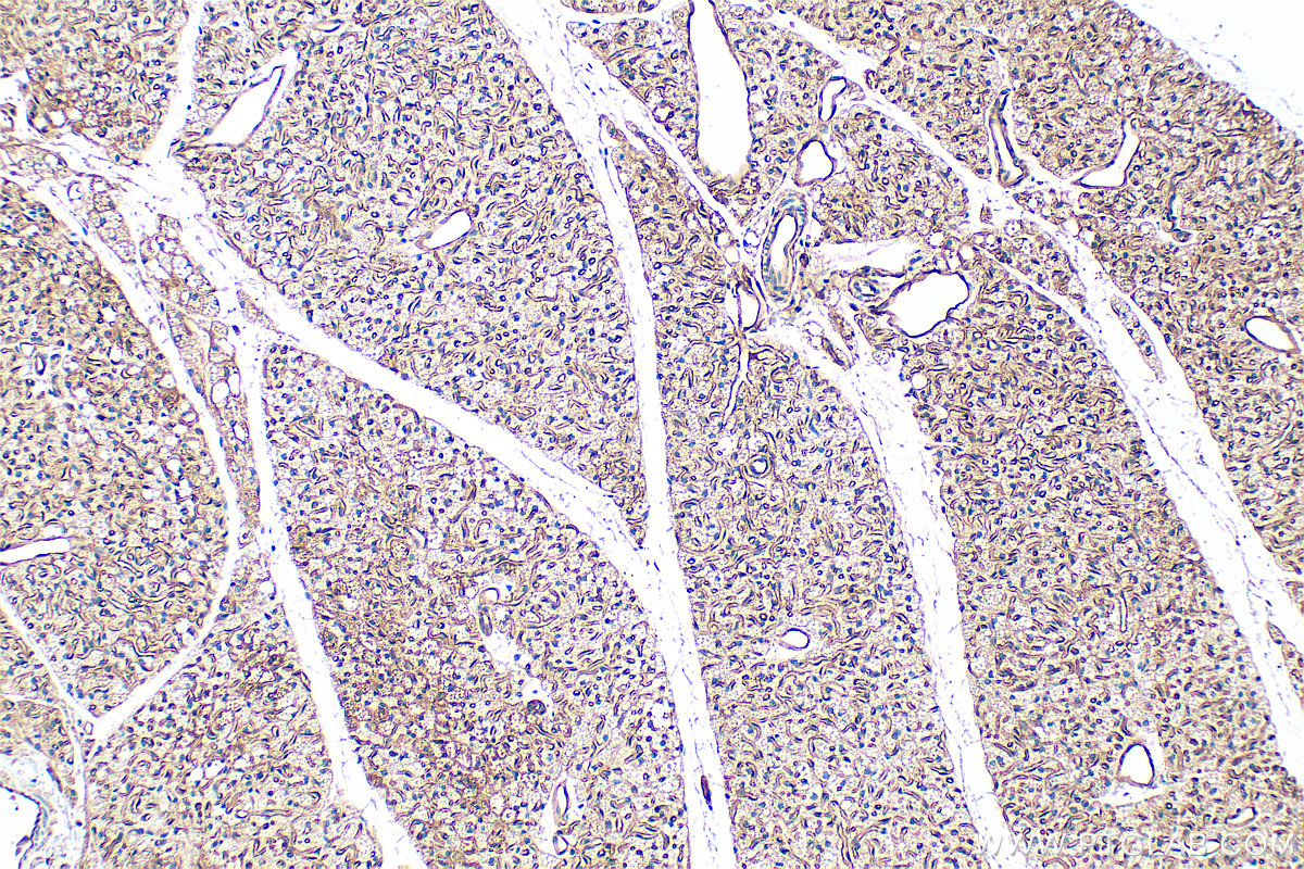 IHC staining of mouse brown adipose using 30723-1-AP