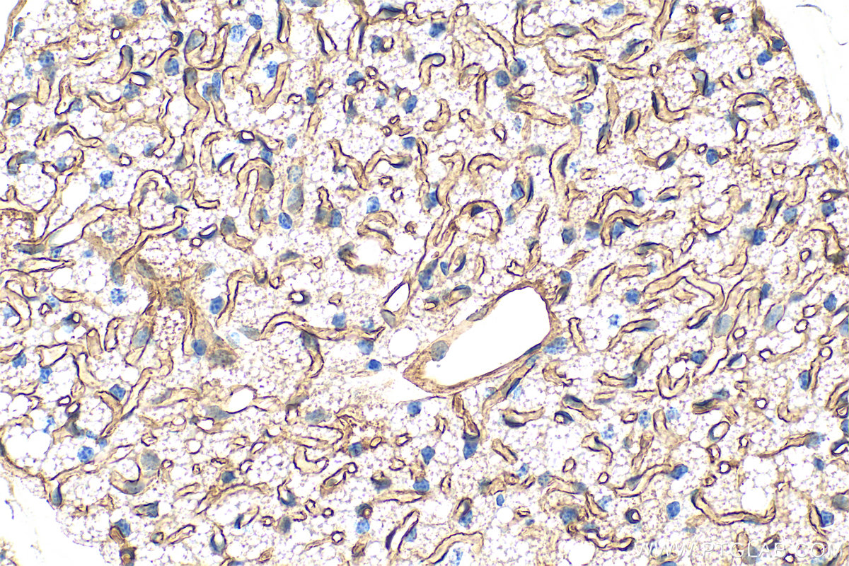 IHC staining of mouse brown adipose using 30723-1-AP