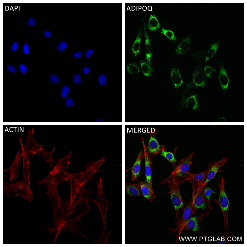 IF Staining of 3T3-L1 using 83961-1-RR
