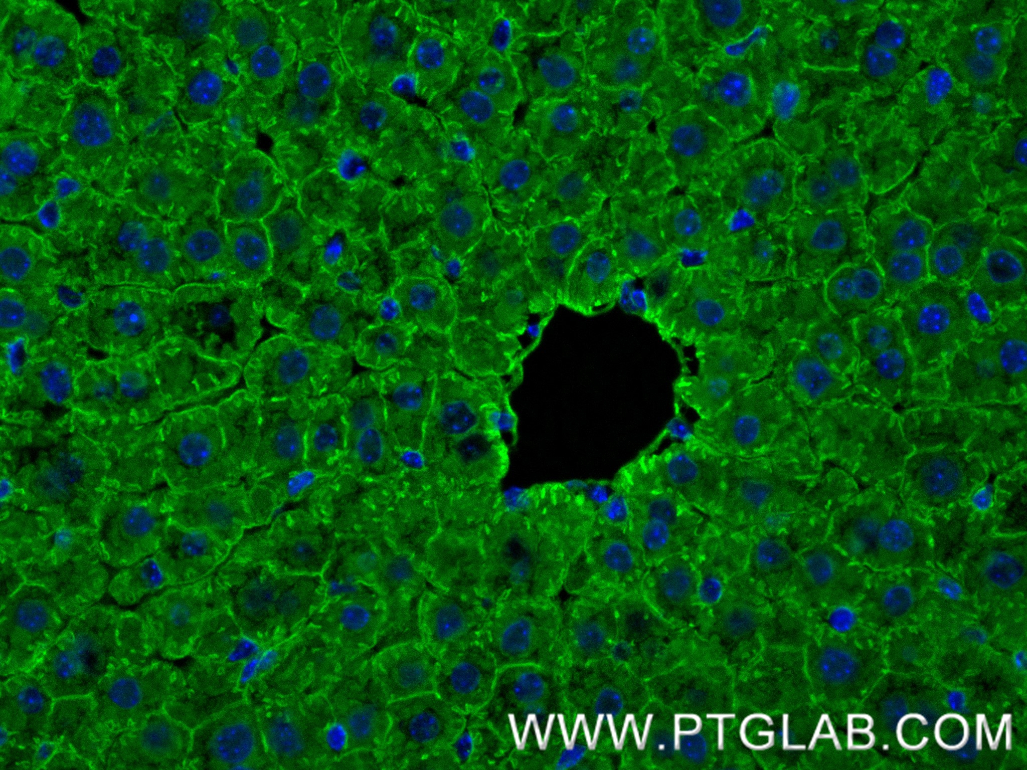 IF Staining of mouse liver using 85121-4-RR