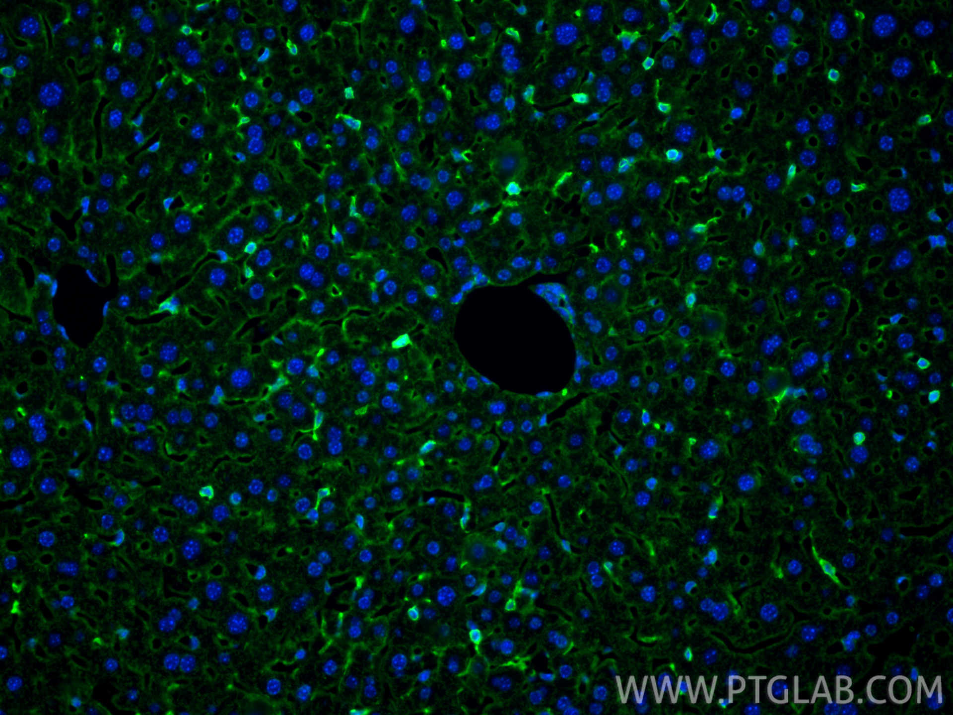 IF Staining of mouse liver using RMX00098