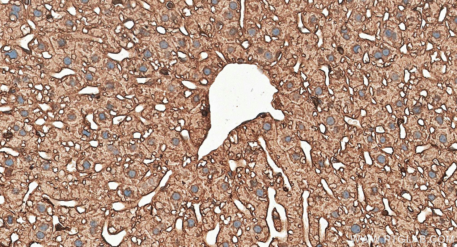 IHC staining of mouse liver using RMX00098