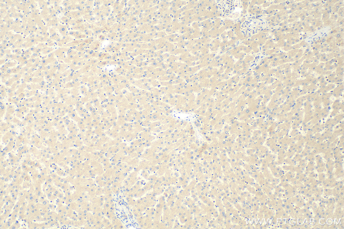 IHC staining of human liver using 25213-1-AP