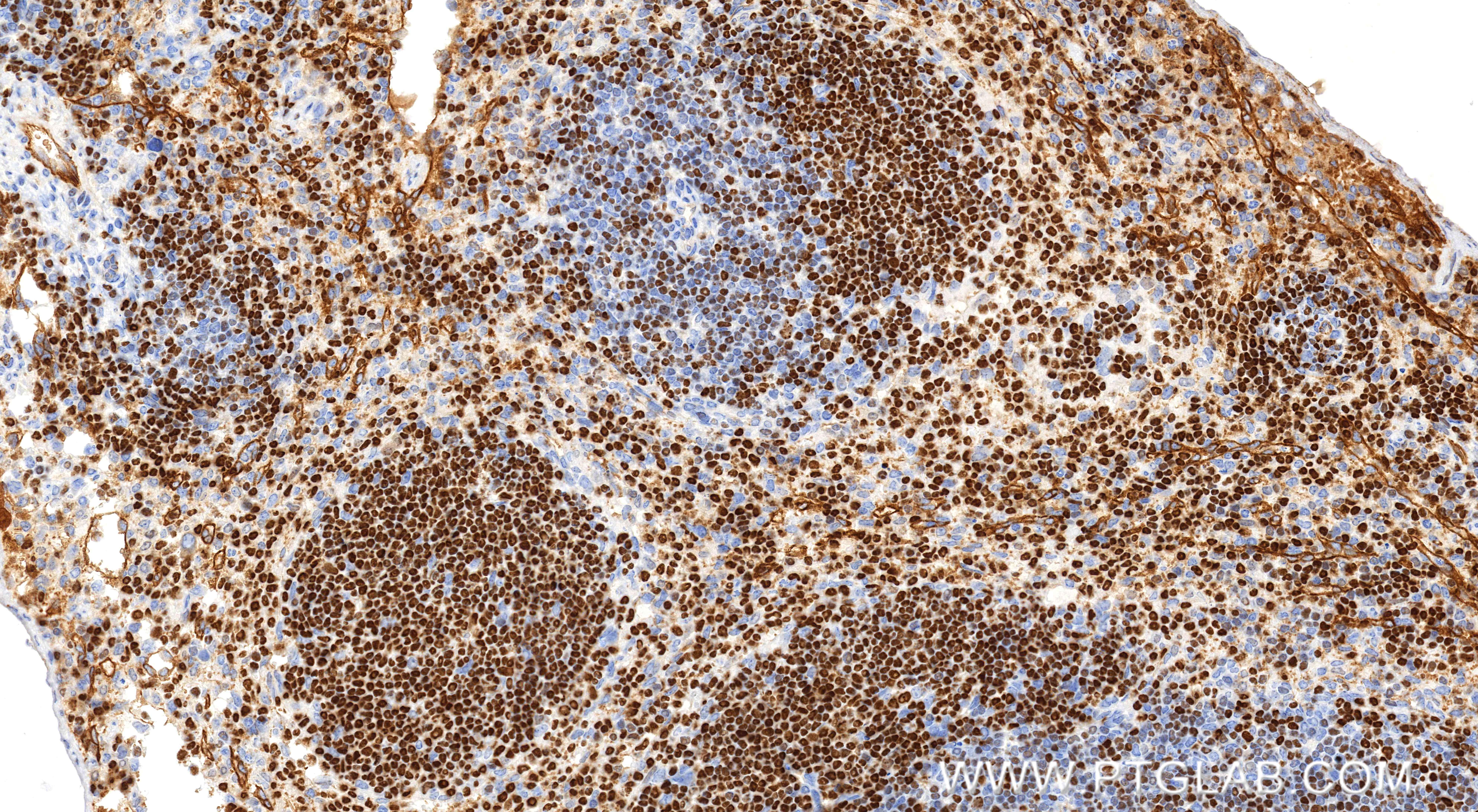 Immunohistochemical analysis of paraffin-embedded mouse spleen tissue slide using 85752-2-RR (Aiolos/IKZF3 antibody) at dilution of 1:1000 (under 20x lens). Heat mediated antigen retrieval with Tris-EDTA buffer (pH 9.0). IHC staining of mouse spleen using 85752-2-RR