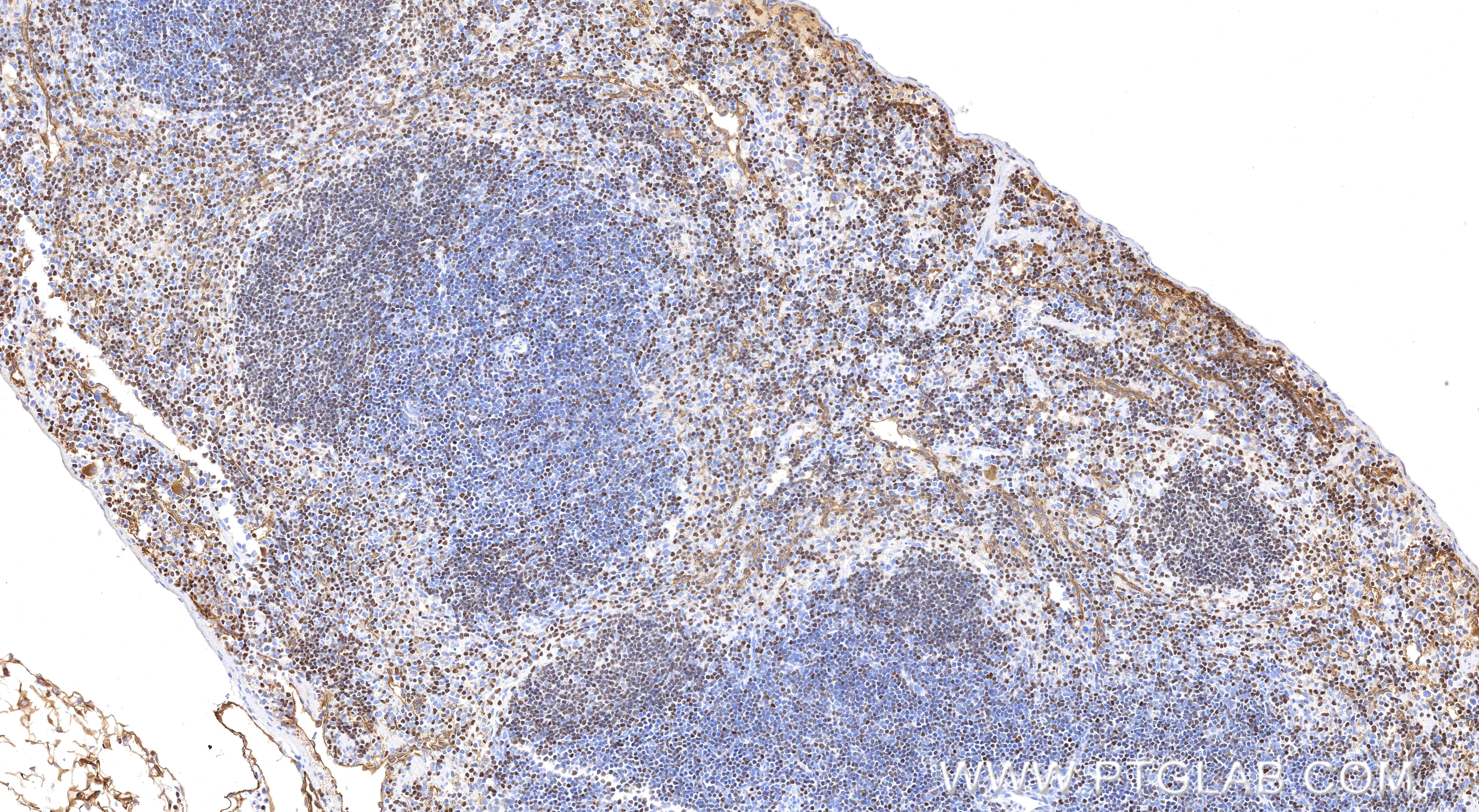 IHC staining of mouse spleen using 85752-2-RR