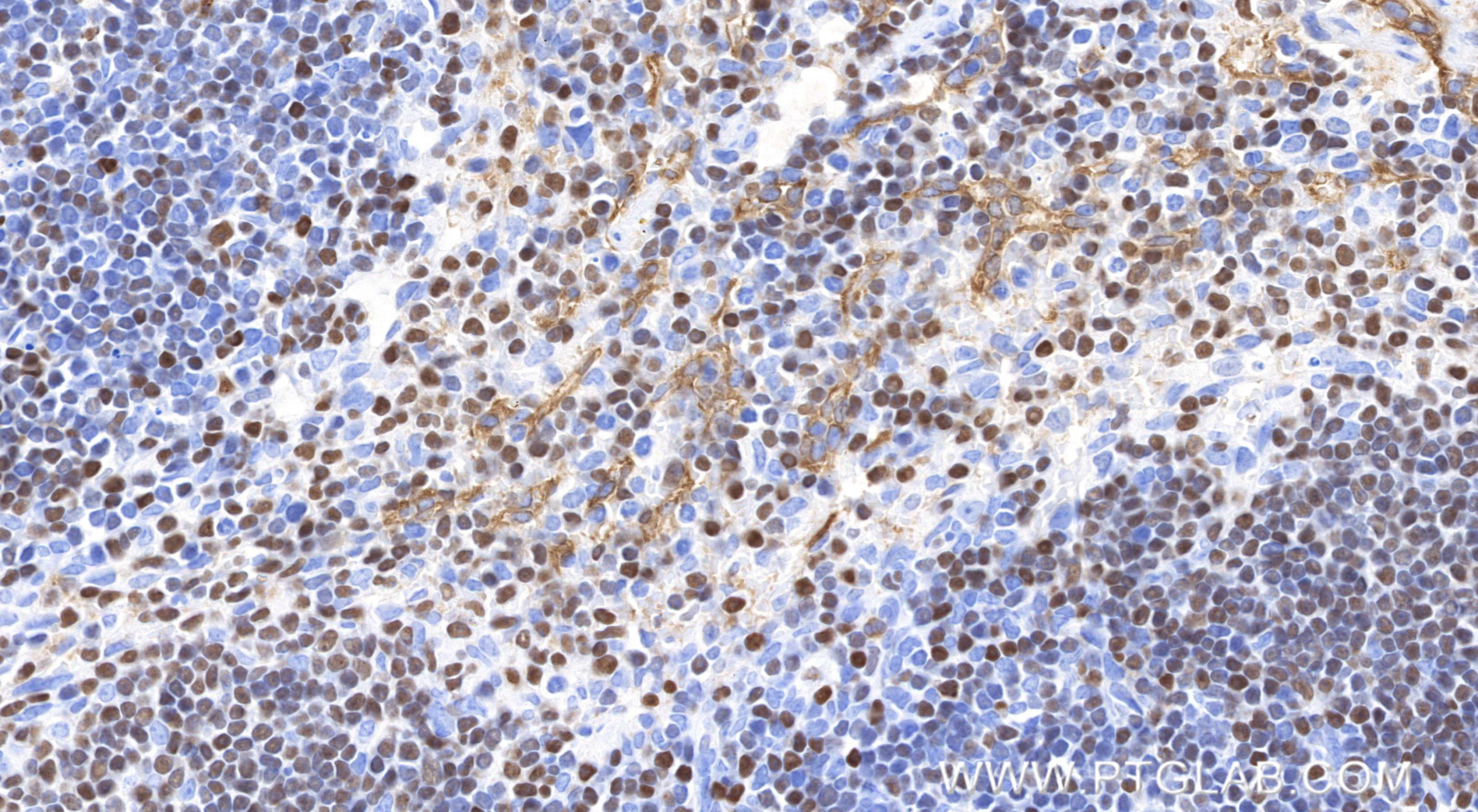 IHC staining of mouse spleen using 85752-2-RR
