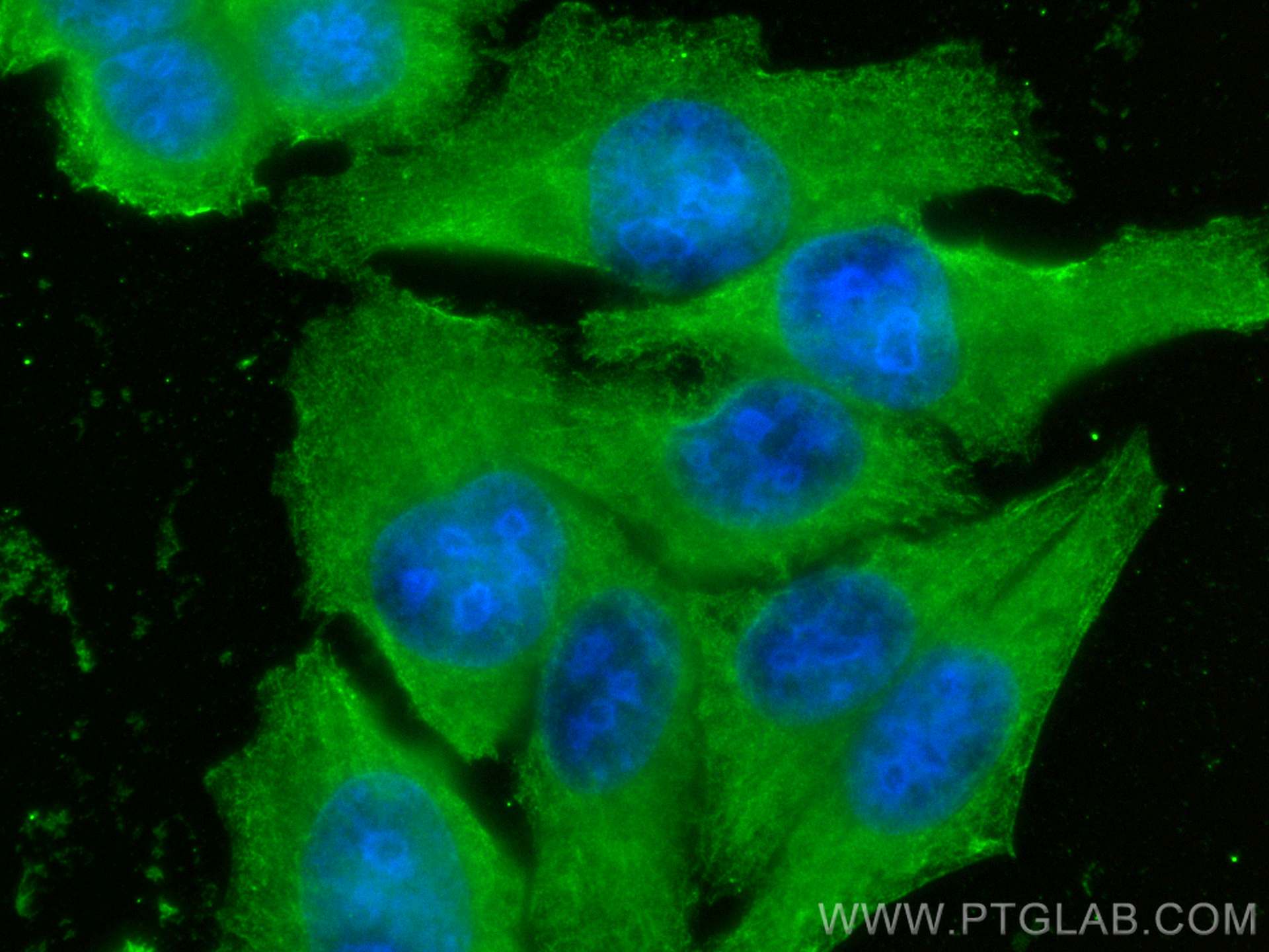 IF Staining of HepG2 using 67909-1-Ig