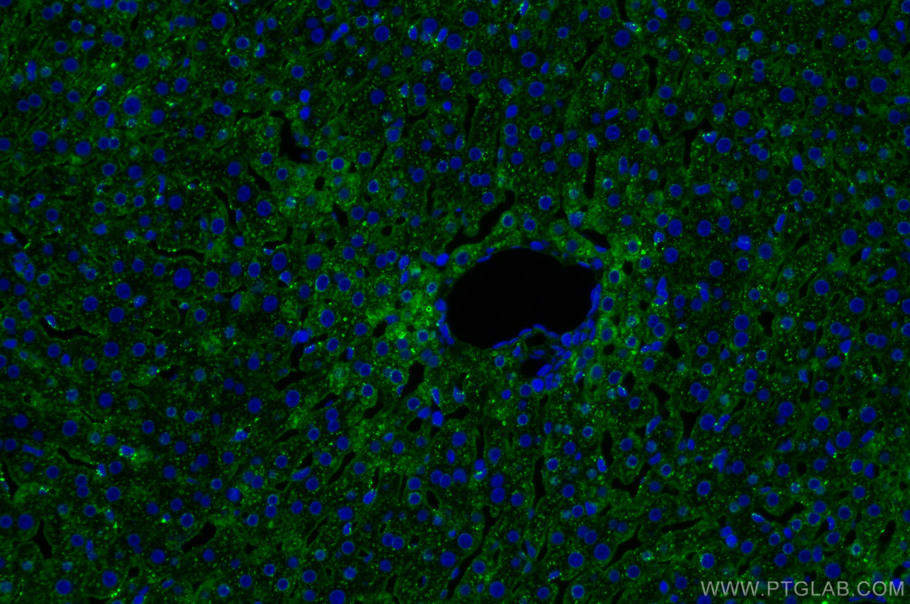 IF Staining of rat liver using 31340-1-AP