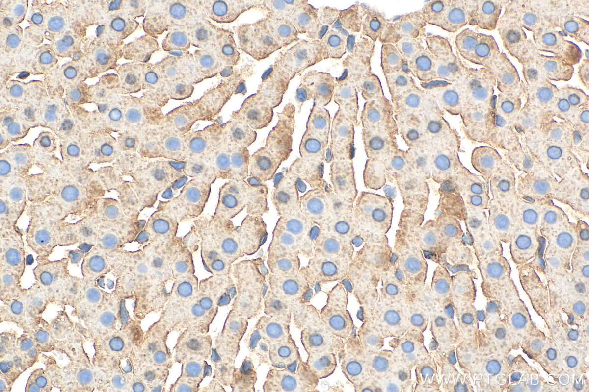 IHC staining of rat liver using 31340-1-AP