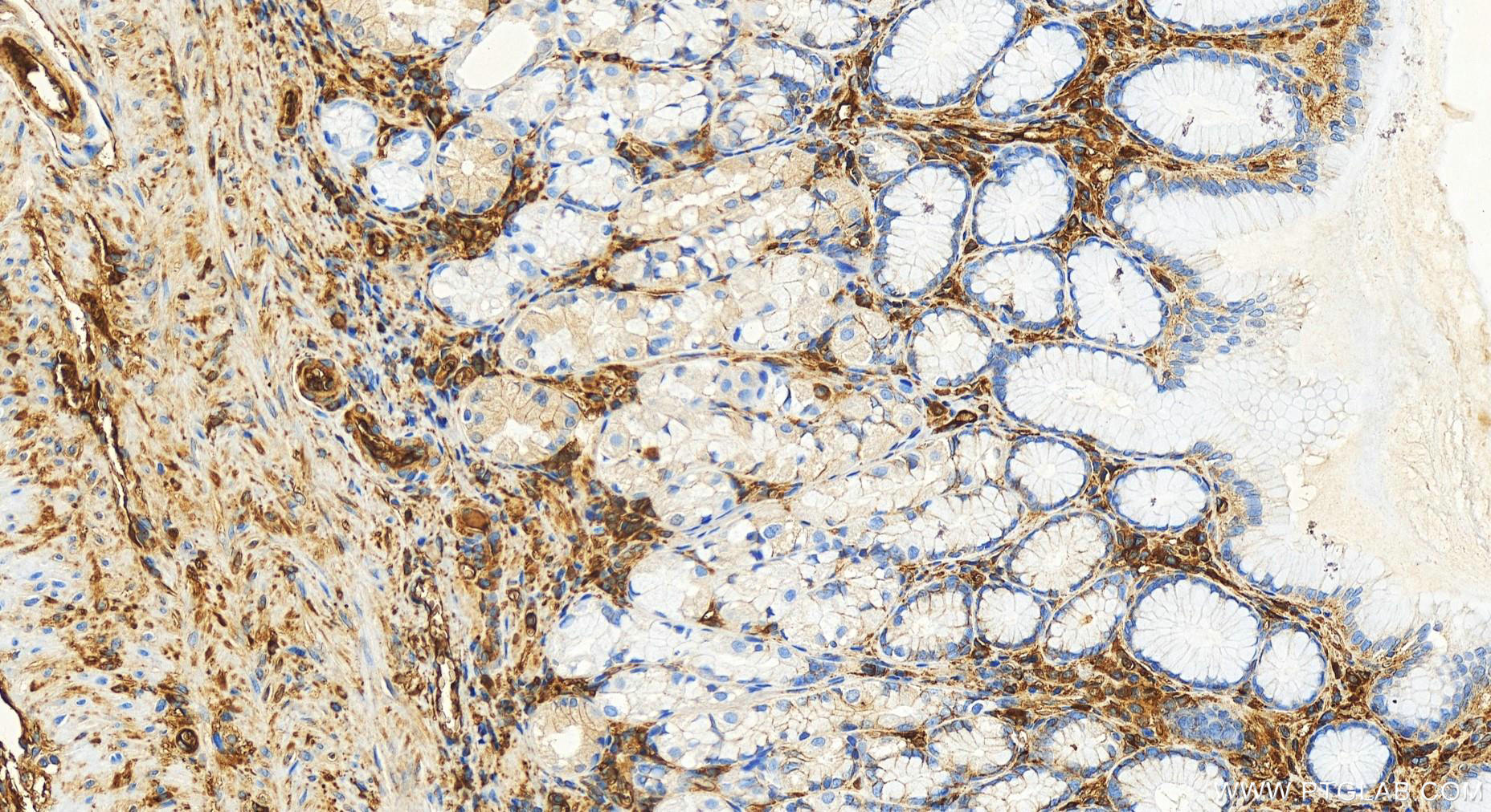 IHC staining of human stomach using 82783-6-RR (same clone as 82783-6-PBS)