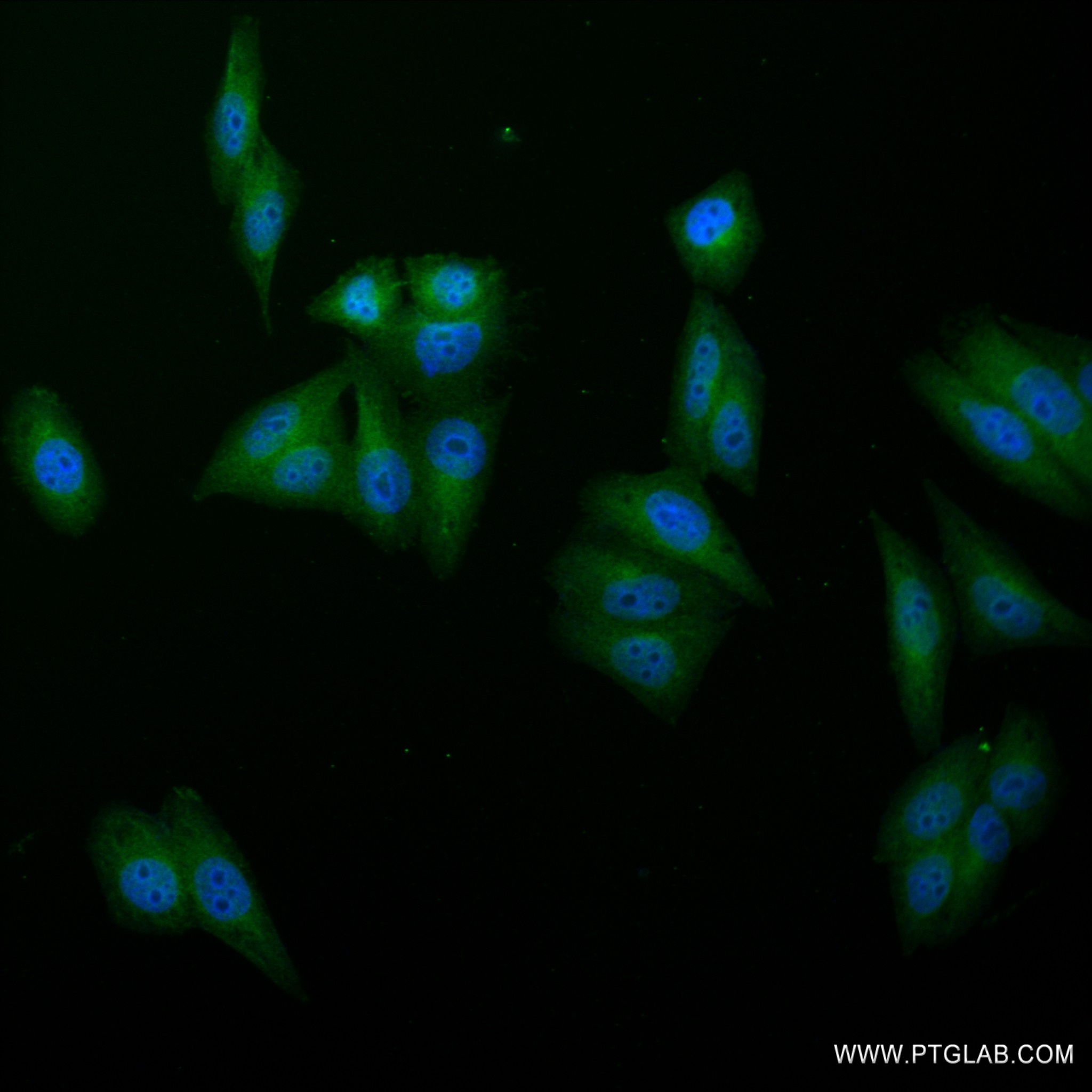 IF Staining of HepG2 using 82783-6-RR (same clone as 82783-6-PBS)