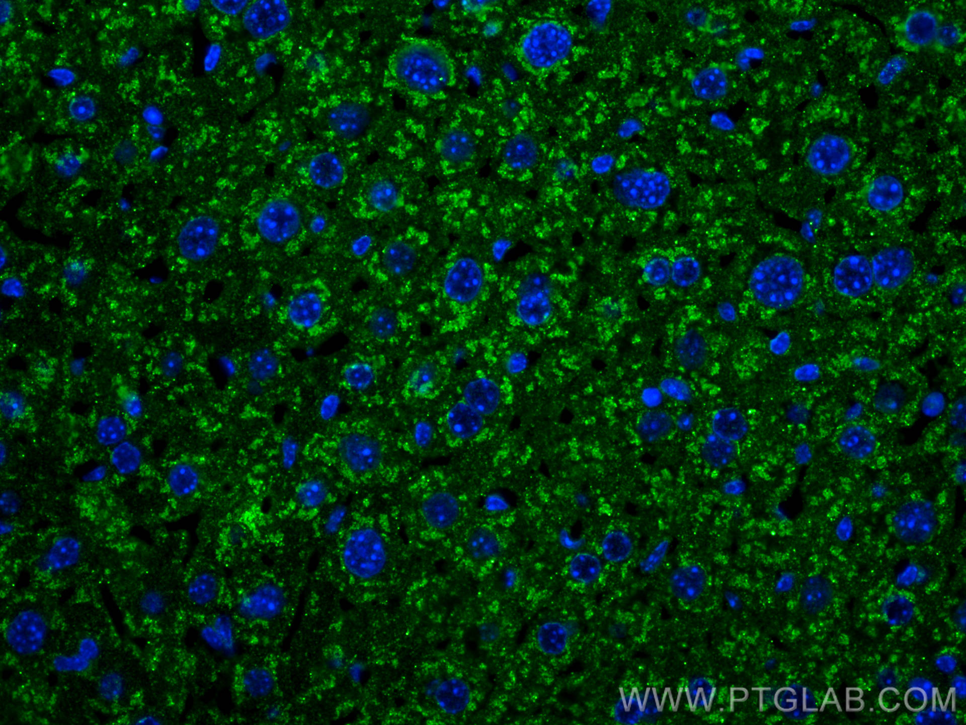 IF Staining of mouse liver using 82783-6-RR (same clone as 82783-6-PBS)