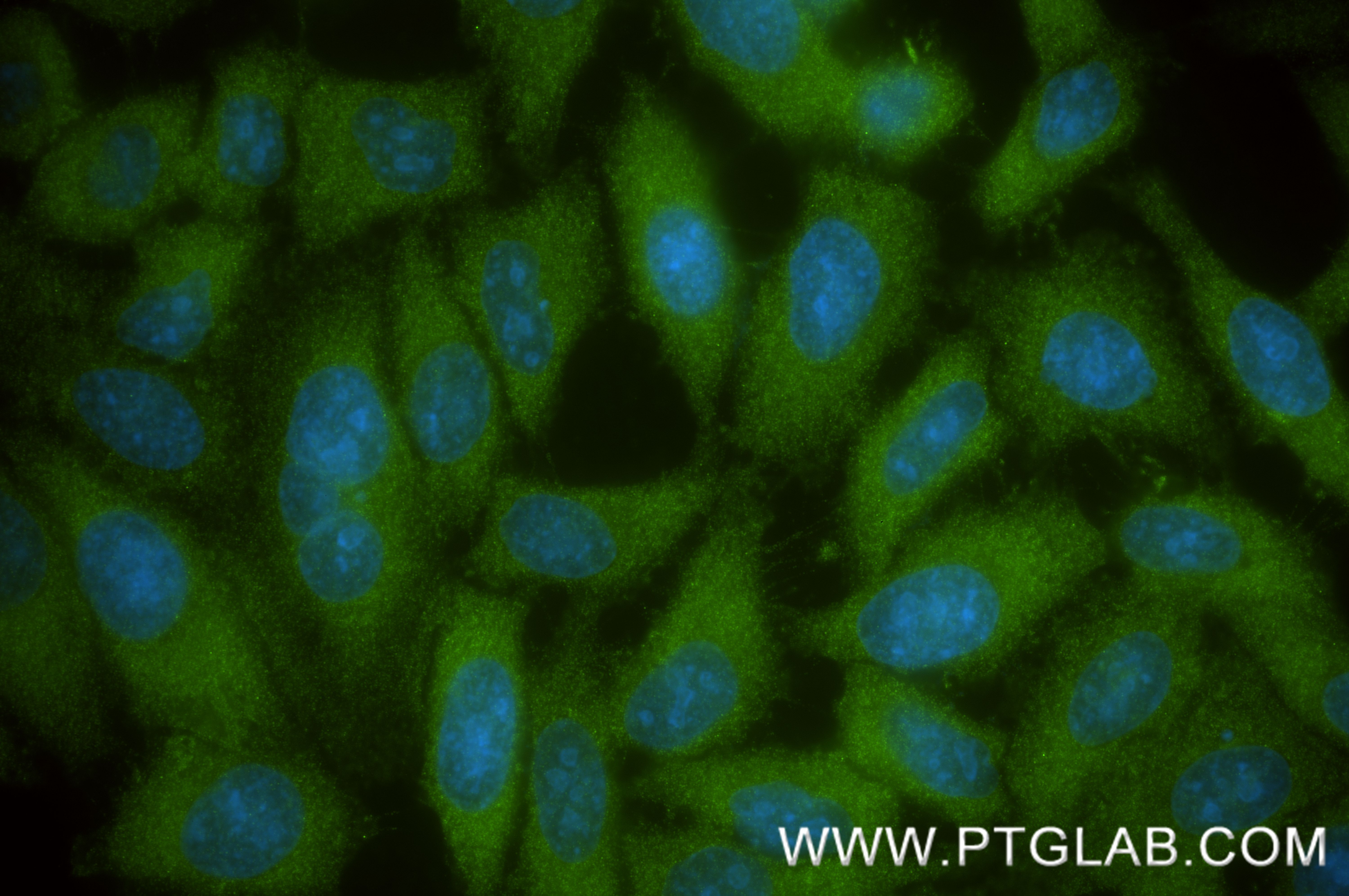 IF Staining of HepG2 using 82783-6-RR IF Staining of HepG2 using 82783-6-RR