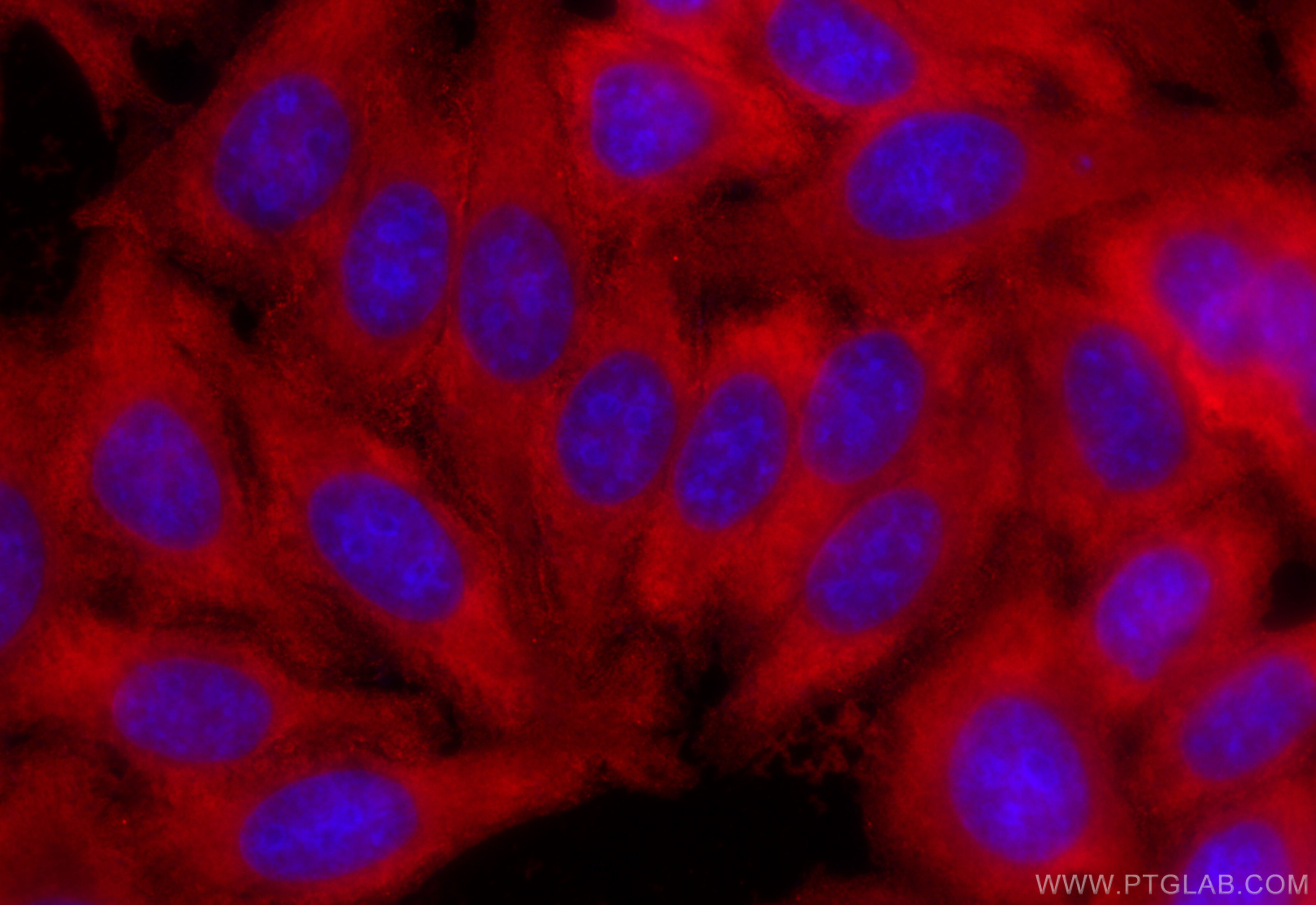 IF Staining of HepG2 using CL594-66120