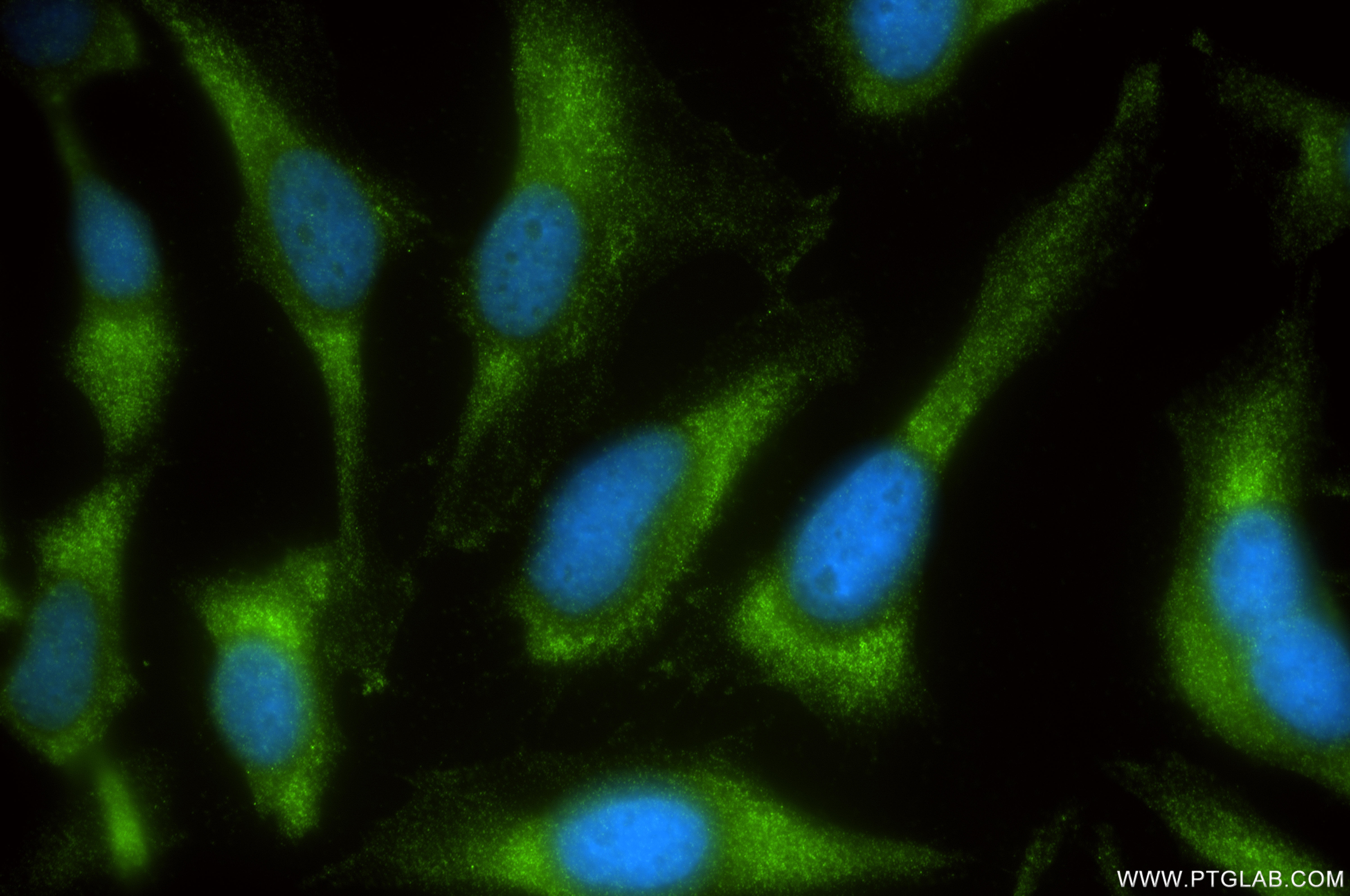 IF Staining of HeLa using 86644-1-RR