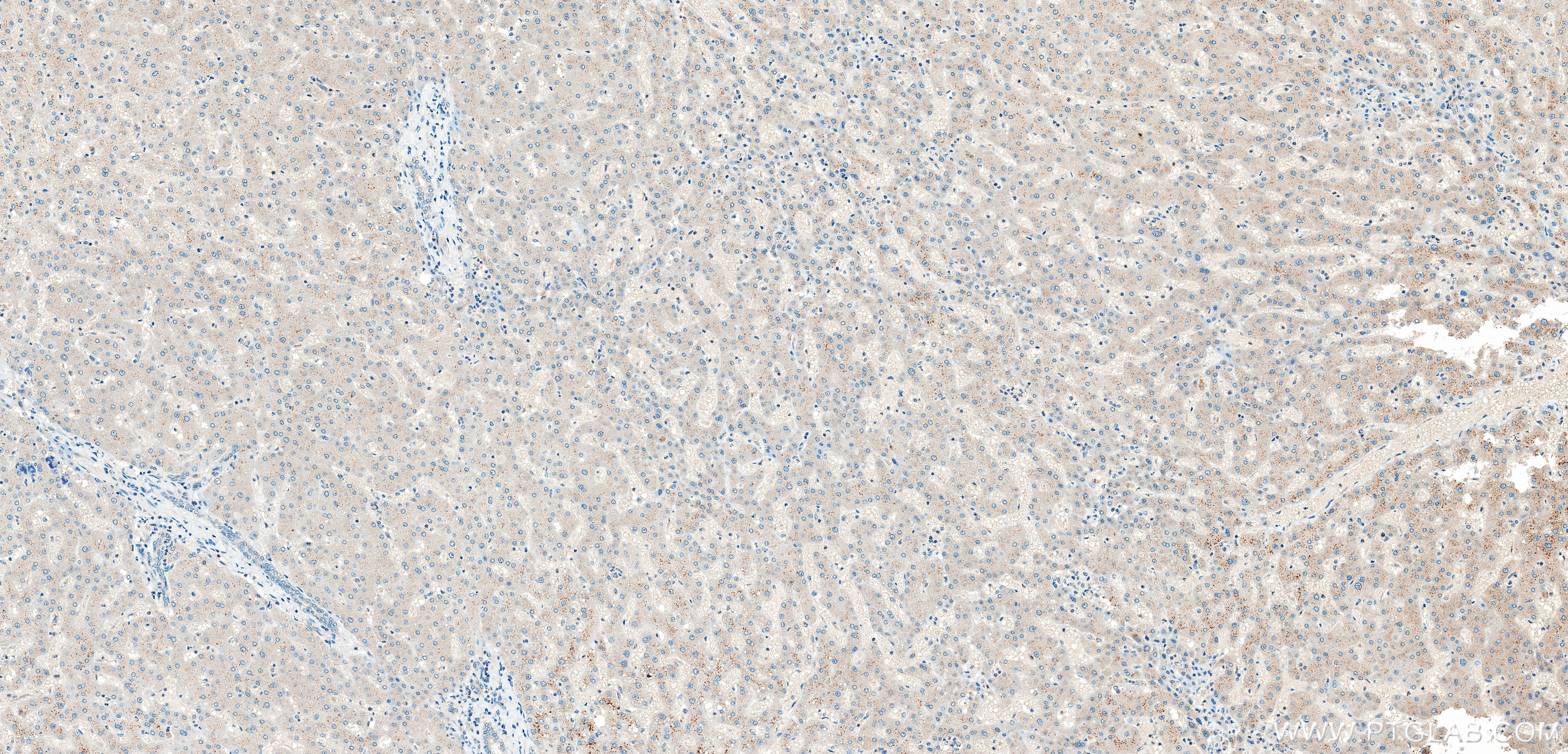 IHC staining of human liver using 86644-1-RR (same clone as 86644-1-PBS) IHC staining of human liver using 86644-1-RR (same clone as 86644-1-PBS)