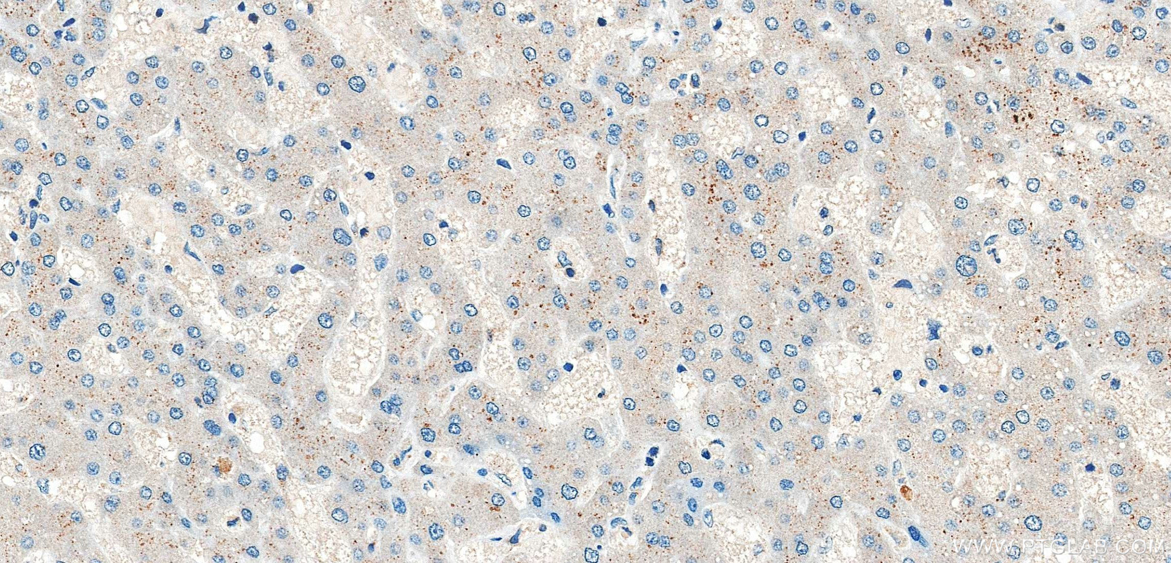 IHC staining of human liver using 86644-1-RR (same clone as 86644-1-PBS) IHC staining of human liver using 86644-1-RR (same clone as 86644-1-PBS)