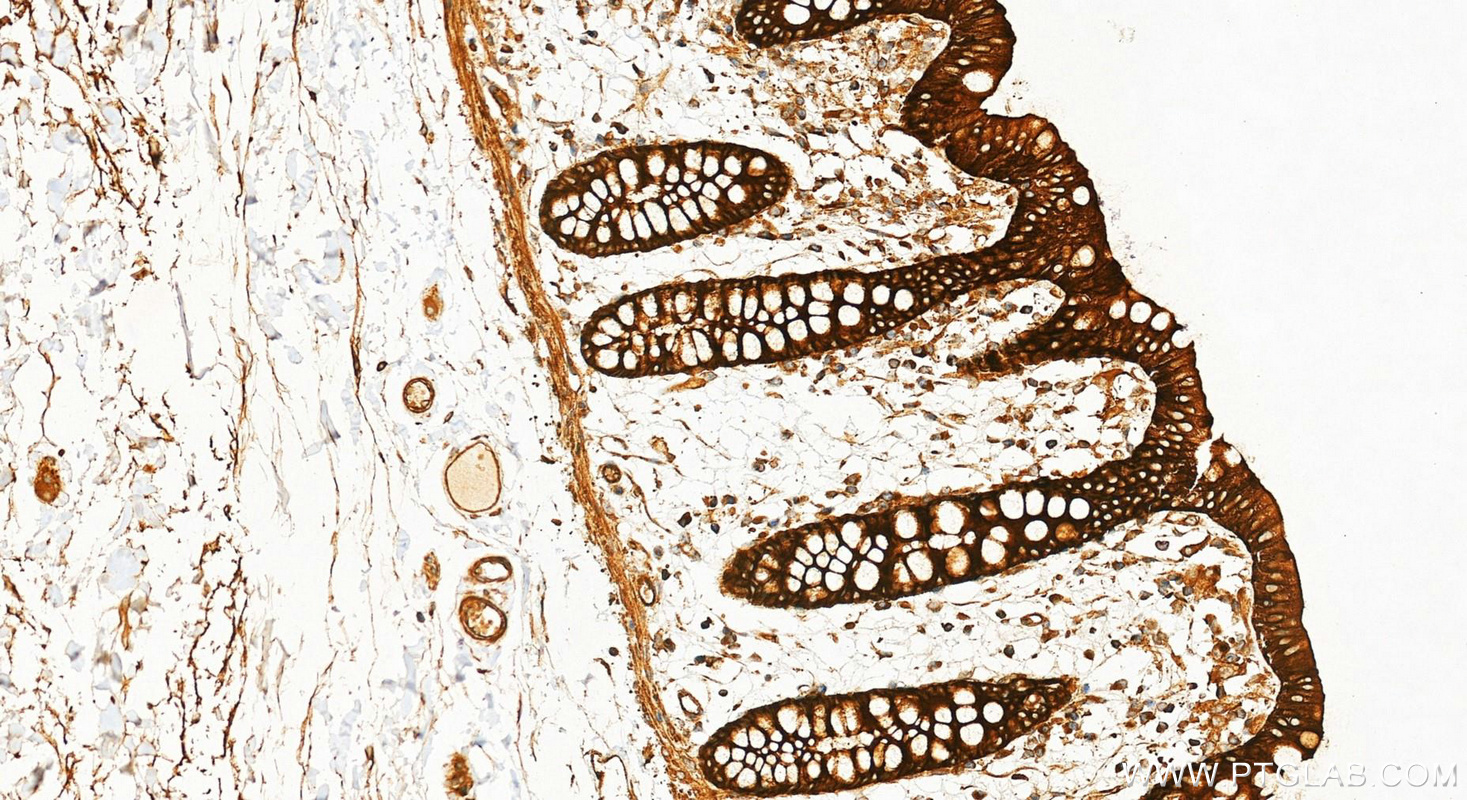 IHC staining of human colon using RMX00081 IHC staining of human colon using RMX00081