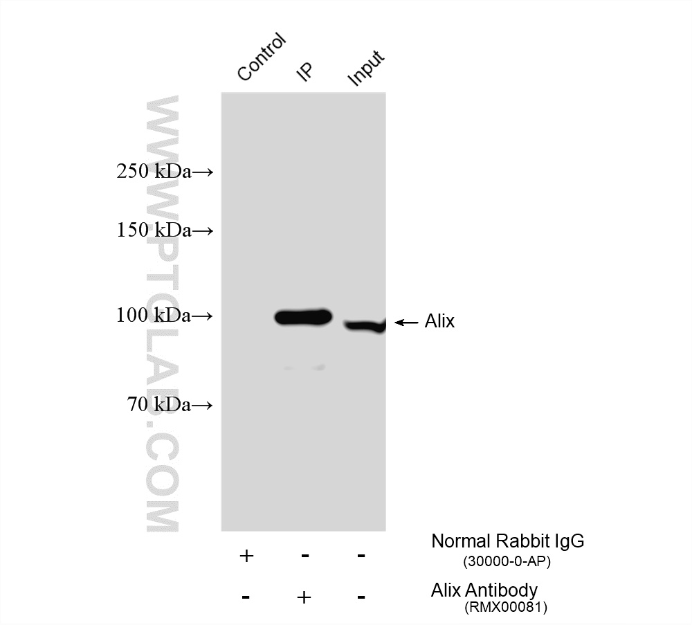 IP experiment of HeLa using RMX00081 IP experiment of HeLa using RMX00081