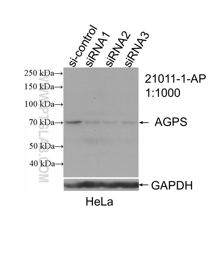 WB analysis of HeLa using 21011-1-AP (same clone as 21011-1-PBS)