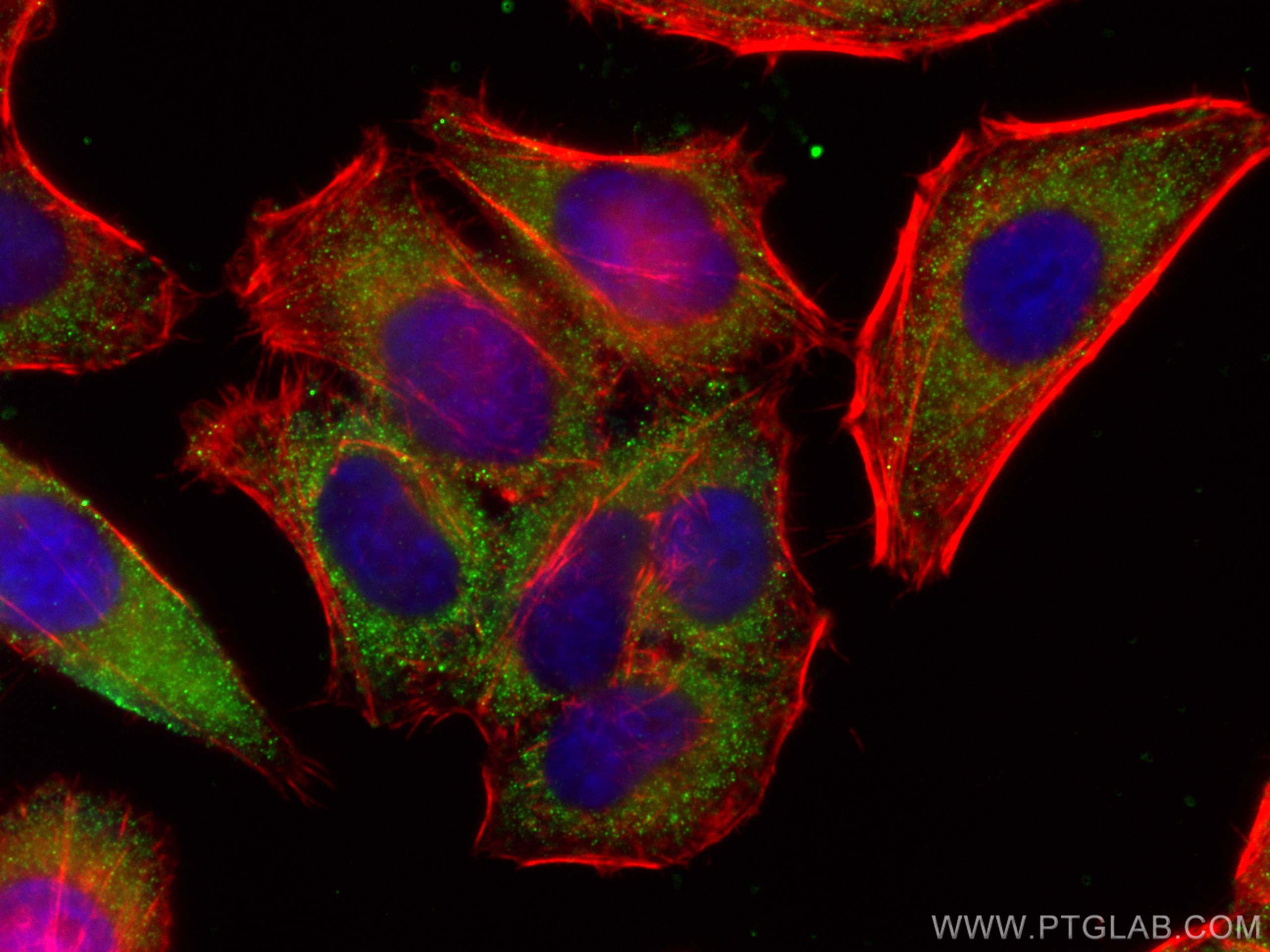 IF Staining of HepG2 using 66135-1-Ig (same clone as 66135-1-PBS)