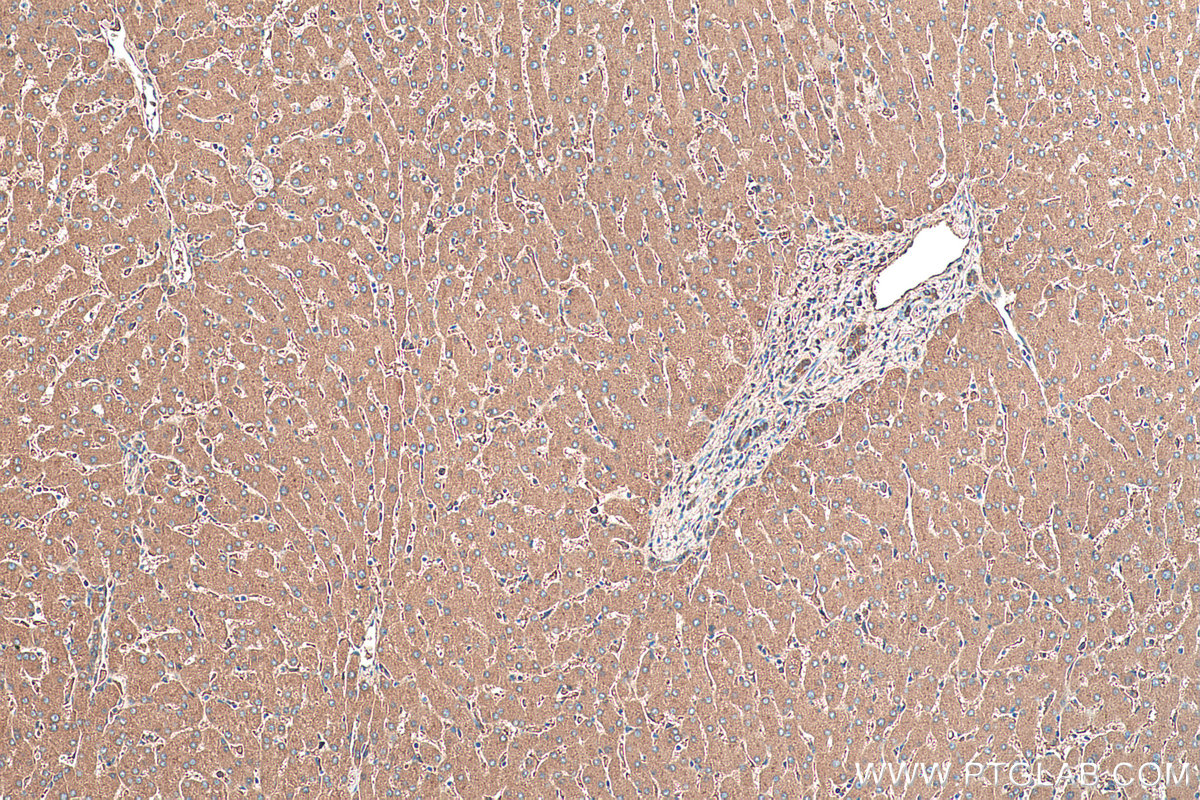 IHC staining of human liver using 66135-1-Ig (same clone as 66135-1-PBS)