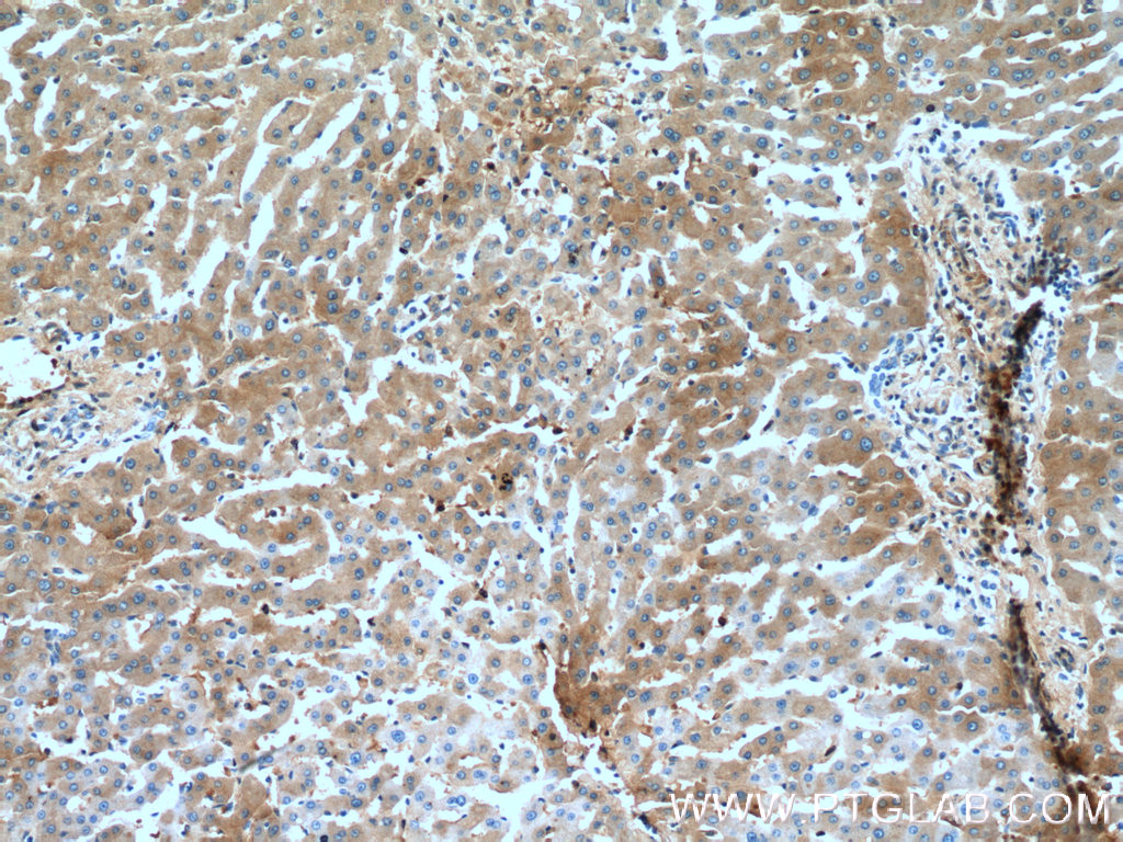 IHC staining of human liver using 66135-1-Ig (same clone as 66135-1-PBS)