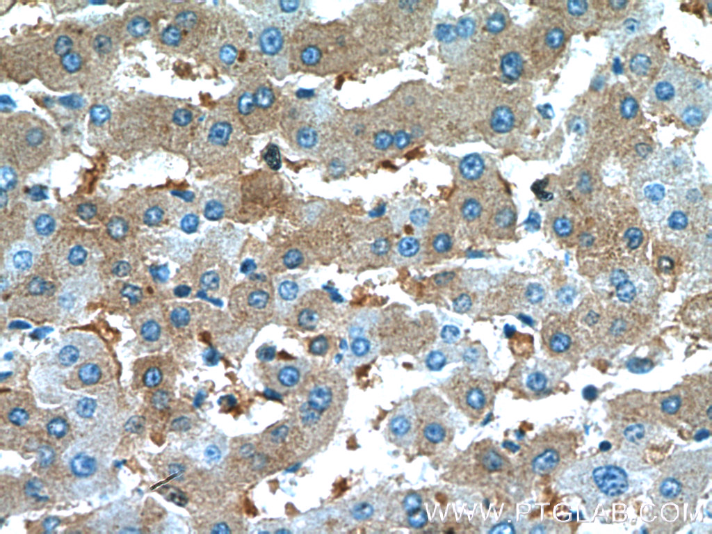 IHC staining of human liver using 66135-1-Ig (same clone as 66135-1-PBS)