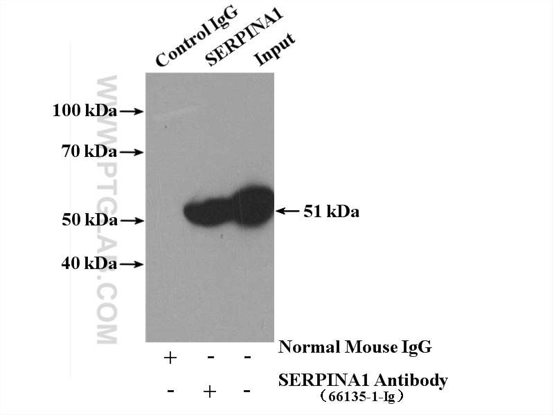 IP experiment of human plasma using 66135-1-Ig (same clone as 66135-1-PBS)