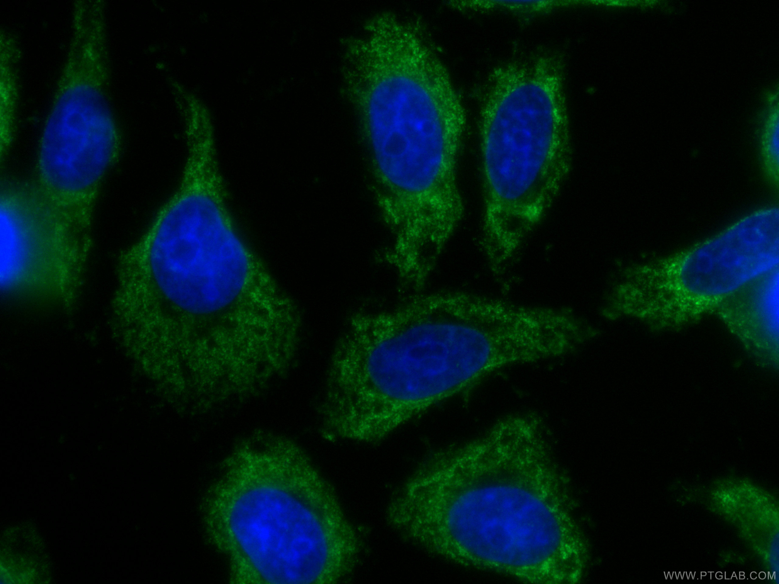 Alpha 1 Antitrypsin