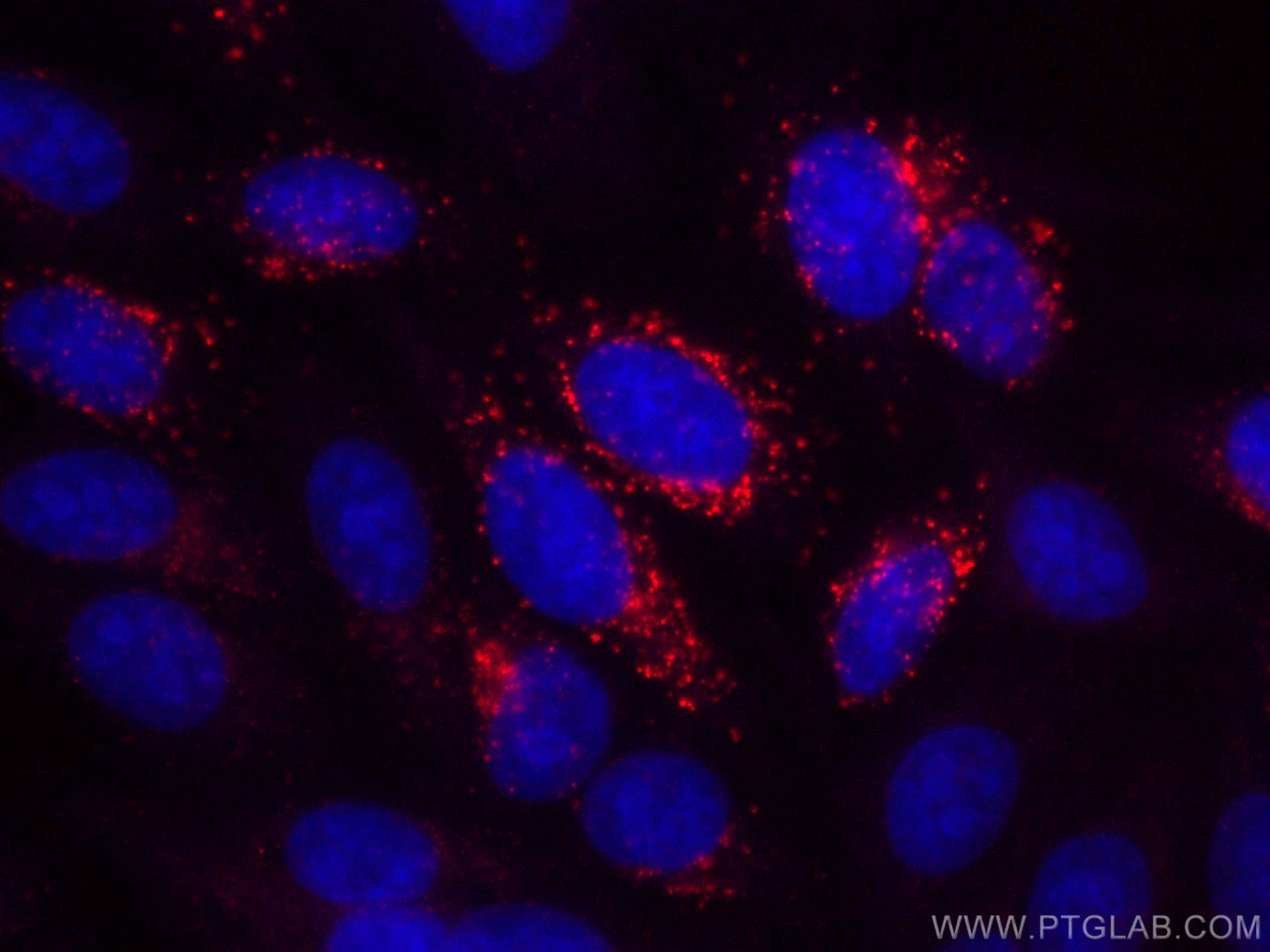 IF Staining of HepG2 using CL594-66260