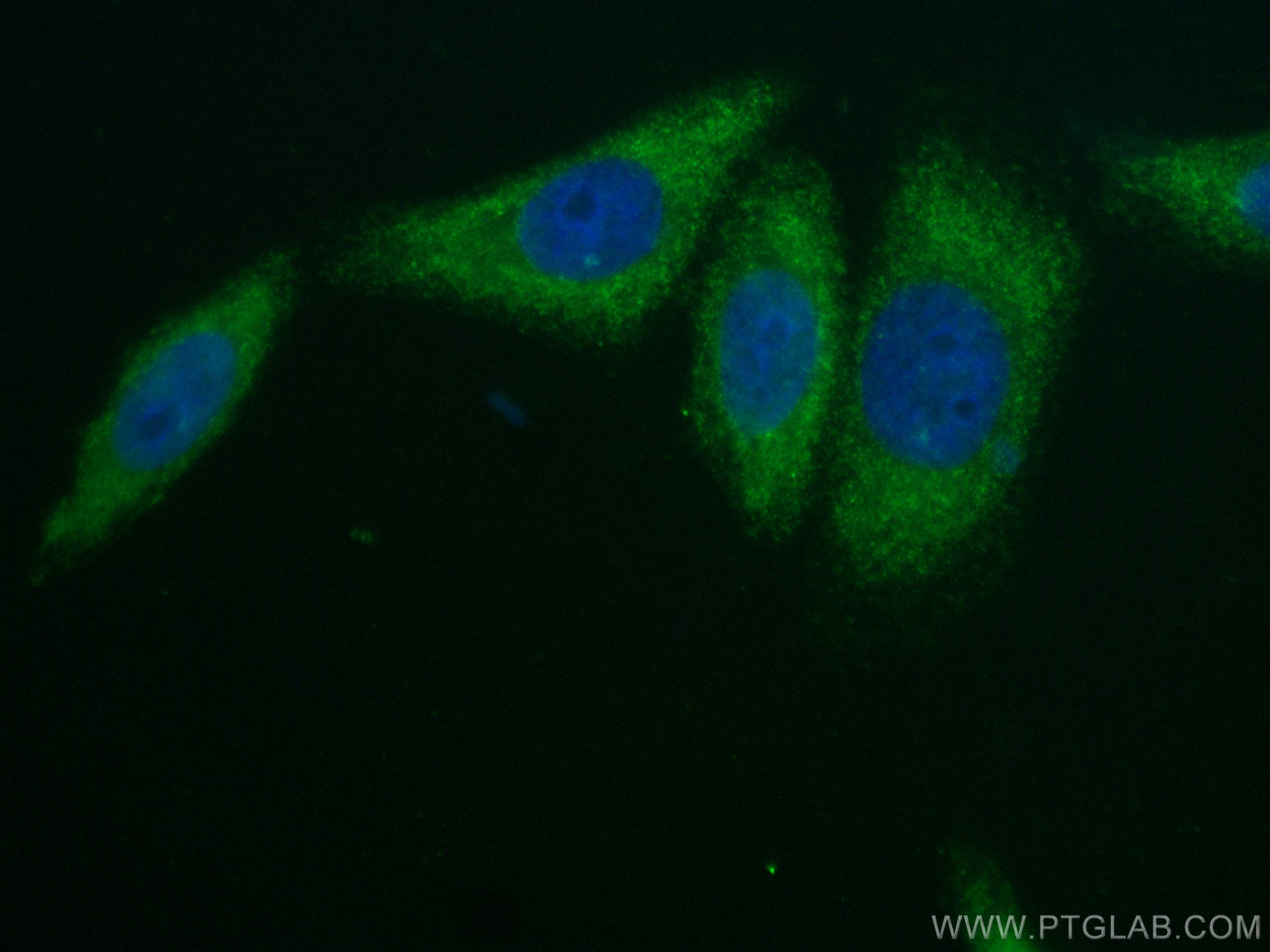 Alpha 2-Antiplasmin