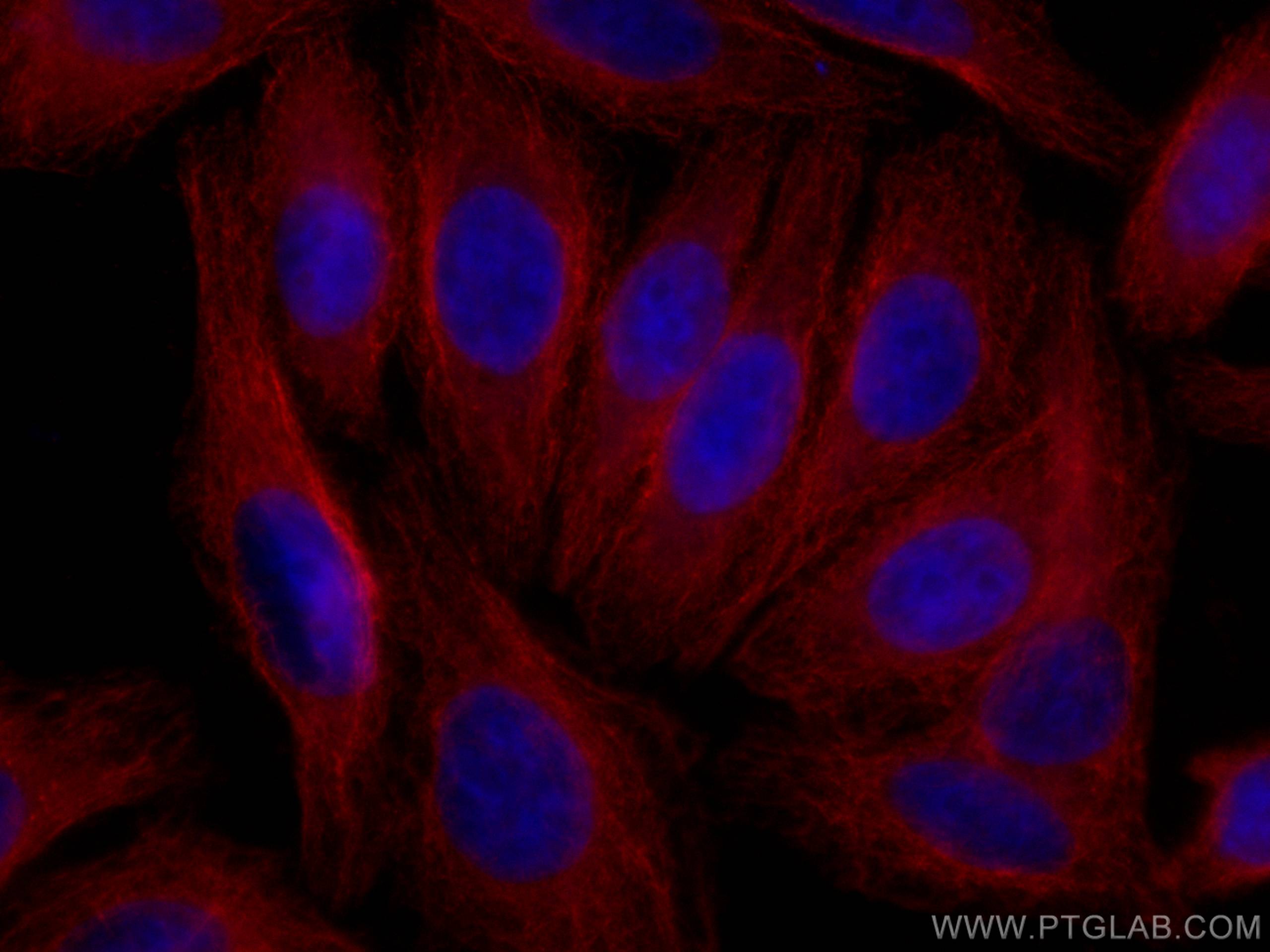 Alpha 2-Antiplasmin