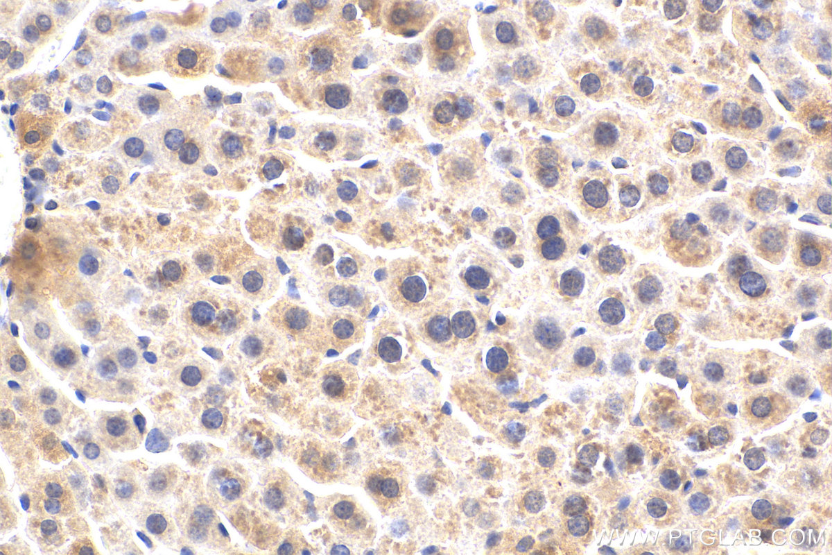 IHC staining of mouse liver using 28549-1-AP